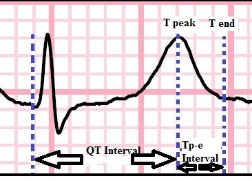 Measurement of QT and Tp-e Interval on
electrocardiograpy.