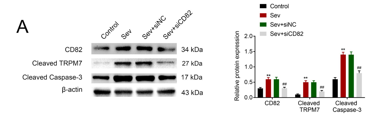 Sevoflurane promoted cleavage of TRPM7 through enhance of 
CD82.Pre-transfection with siCD82 attenuated sevoflurane-induced increase oin CD82, cleaved TRPM7 and cleaved caspase 3 expression. **, ## p < 0.01.