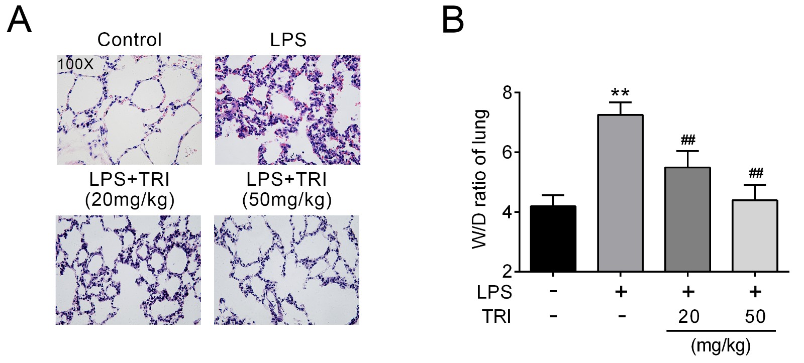 Trilobatin alleviated tissue injury in lungs of mice with
LPS-induced ALI.Lung tissues in each group were processed for histological evaluation 12
hours after LPS treatment.W/D ratio in each group was determined 12 hours after LPS treatment.
**p < 0.01 vs. Control, ## p < 0.01 vs. LPS.