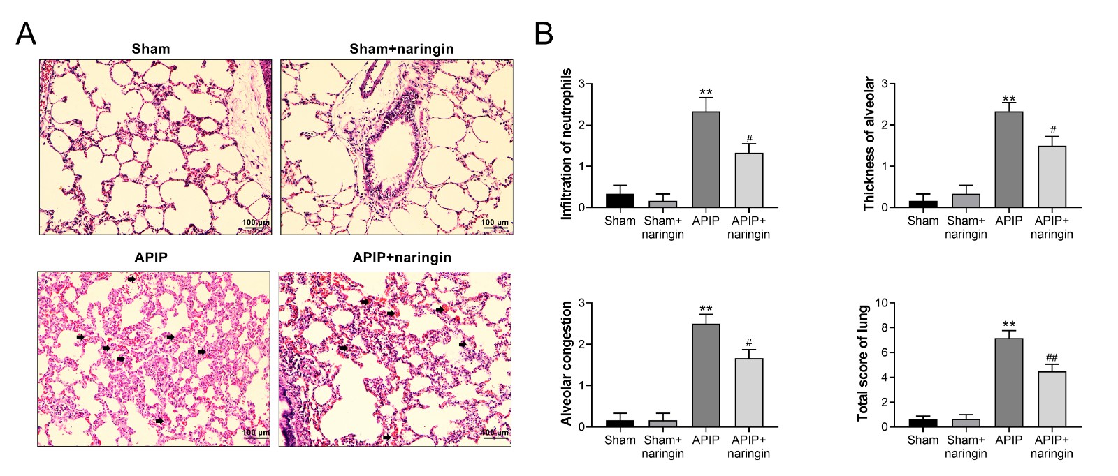 Amelioration of histopathologic injury in lung by naringin.(A) Representative pathological changes in lungs detected by H&E
staining in magnification of ×200. Scale bars: 100 μm.
(B) Histological scores of inflammatory cells, thickness of alveolar
walls alveolus collapse and total score of lung of lungs. (n = 6).
** p < 0.01
vs. sham group, #, ## p < 0.05, p < 0.01 vs. APIP group.