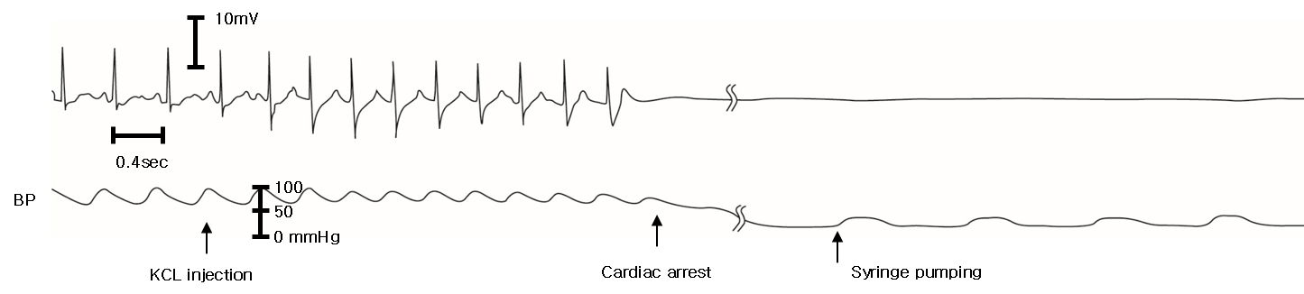 ECG and femoral arterial blood pressure recording. Mean blood
pressure (MBP) was 80 mmHg, heart rate 134/min, and the CVP 6 mmHg before cardiac
arrest. After KCL injection, the ECG showed P-R interval prolongation and
subsequently progressed to P wave loss, QRS complex widening, and T wave peaking,
which resulted in immediate cardiac arrest. Syringe movement began immediately
after extracorporeal circulation was established. When the syringe plunger was
initially depressed, femoral arterial blood pressure was 36/8 mmHg (MBP 18 mmHg),
CVP 8 mmHg at 62 beats/min.
