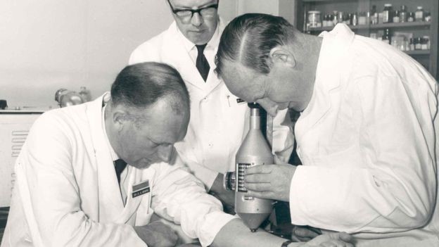 Stewart Adams and his Colleagues, studying the degrees of inflammation on themselves.