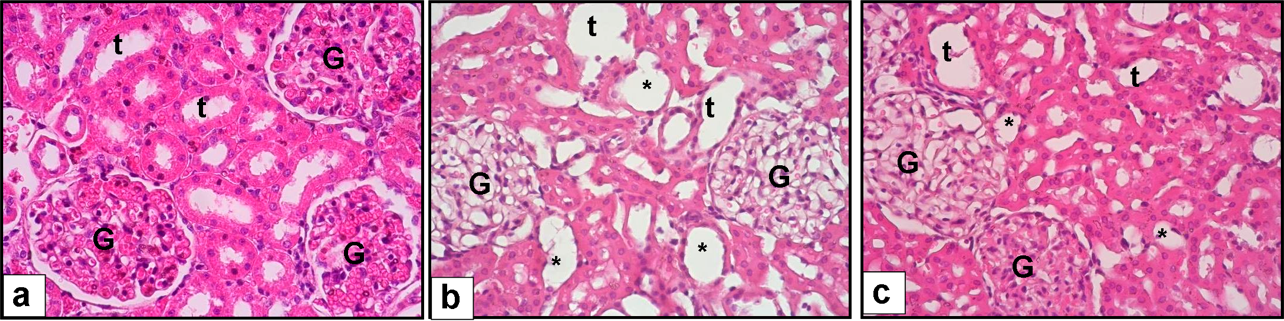 Kidney histolopathology H&E (× 40). a: Control group, normal glomerul (G) and tubul (t), b: Colistin and
Saline given group, tubuler dilatation and tubuler epithelial cell injury (*), c:
Colistin and Dapagliflozin group, decreased tubuler dilatation and tubuler
epithelial cell injury (*).