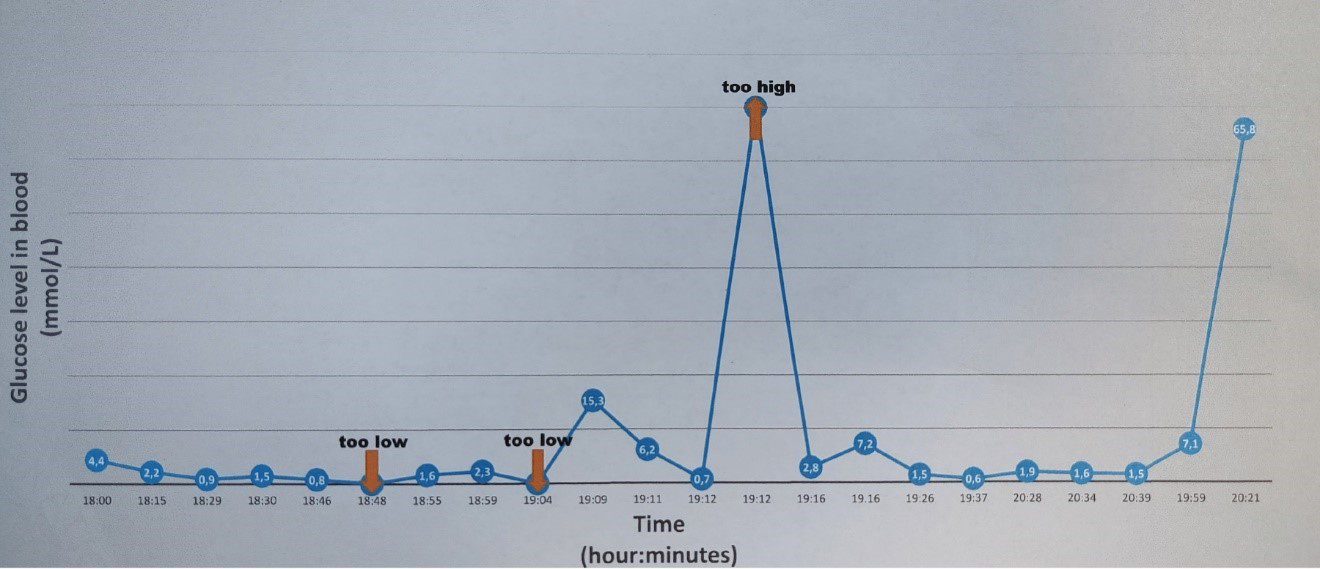 Blood Glucose Measurements during Cardiopulmonary Resuscitation.