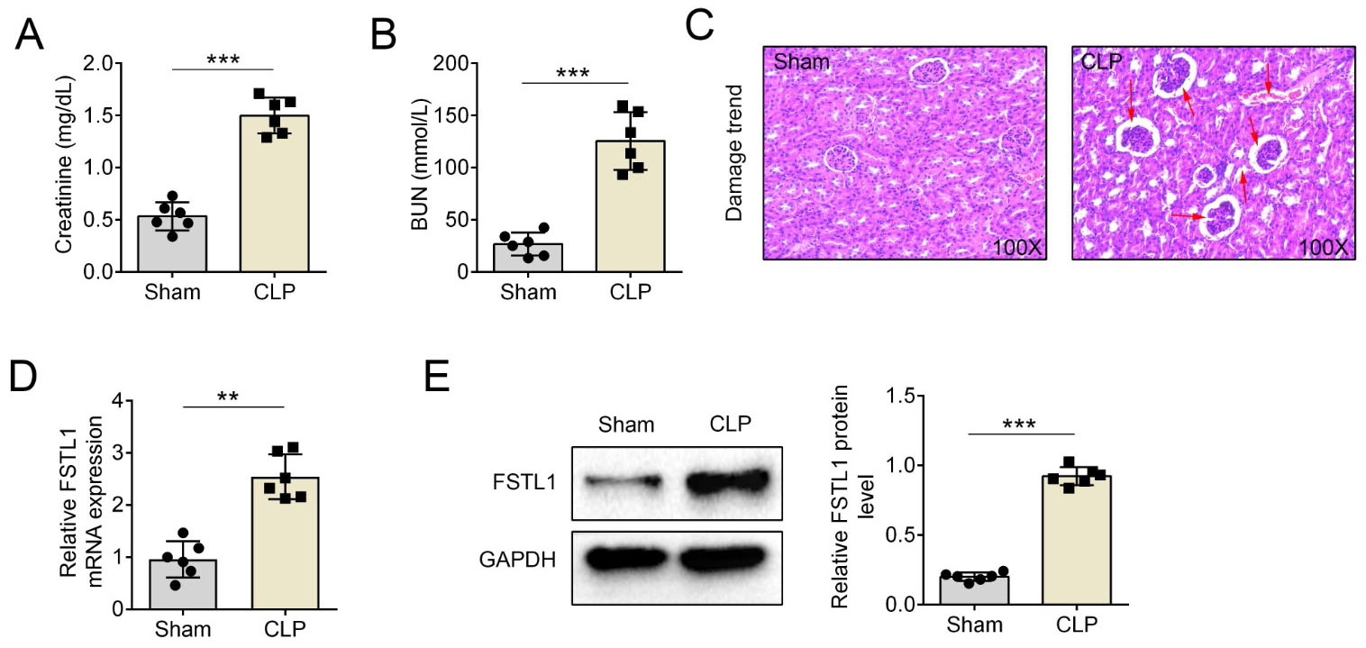 FSTL1 is significantly up-regulated in kidney after CLP. (A)
and (B) The levels of creatinine and blood urea nitrogen (BUN) in serum were
examined using commercially available kits. (C) Hematoxylin-eosin (HE) staining
was performed and histological analysis showed tubular degeneration and
vacuolization. Scale bars: 100×. (D) The FSTL1 mRNA levels were detected
using qRT-PCR, and (E) protein levels were measured using western blotting.
**p < 0.001, ***p < 0.001.