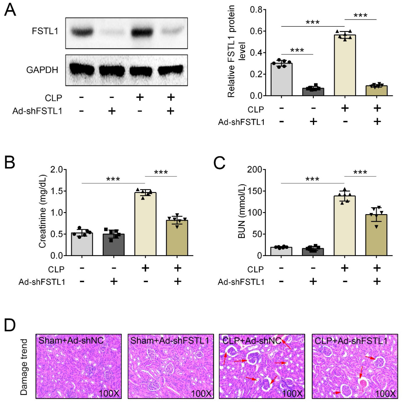 FSTL1 inhibition alleviates acute kidney injury after CLP. (A)
An adenoviral vector expressing shRNA targeting FSTL1 was injected into rats
prior to CLP to achieve FSTL1 knockdown, FSTL1 protein levels were quantified via
western blotting. (B) and (C) show the levels of creatinine and blood urea
nitrogen (BUN) in serum. (D) HE staining was performed for histological analysis
showing tubular degeneration and vacuolization. Scale bars: 100×.
***p < 0.001.