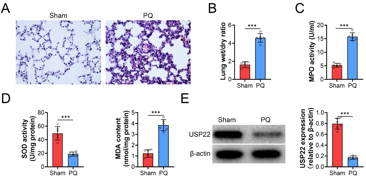Paraquat (PQ) induced lung injury and decreased USP22
expression. (A) HE staining was performed to assess lung injury in mice treated
with PQ. (B) Lung wet/dry ratio was determined in mice treated with PQ. (C) The
activity of MPO in lung tissues was measured in mice treated with PQ. (D) The
activity of SOD and the content of MDA were measured in lung tissues of mice
treated with PQ. (E) Western blot was conducted to determine the protein level of
USP22 in lung tissues of mice treated with PQ. ***: p < 0.001.