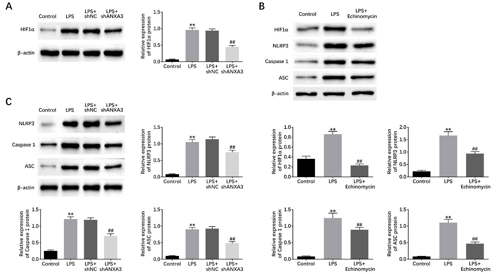 ANXA3 depletion inhibited HIF1α-induced NLRP3 
inflammasome activity. (A) Immunoblot showed the expression of HIF1α in 
BEAS-2B cells upon the indicated treatment. (B) Immunoblot showed the expression 
of NLRP3, Caspase1, and ASC in BEAS-2B cells upon the indicated treatment. (C) 
Immunoblot showed the expression of NLRP3, Caspase1, and ASC in BEAS-2B cells 
upon the indicated treatment. Results are presented as mean ± SEM, LPS vs 
control, ** p < 0.01, LPS + shANXA3 vs LPS + shNC, ## p < 
0.01.