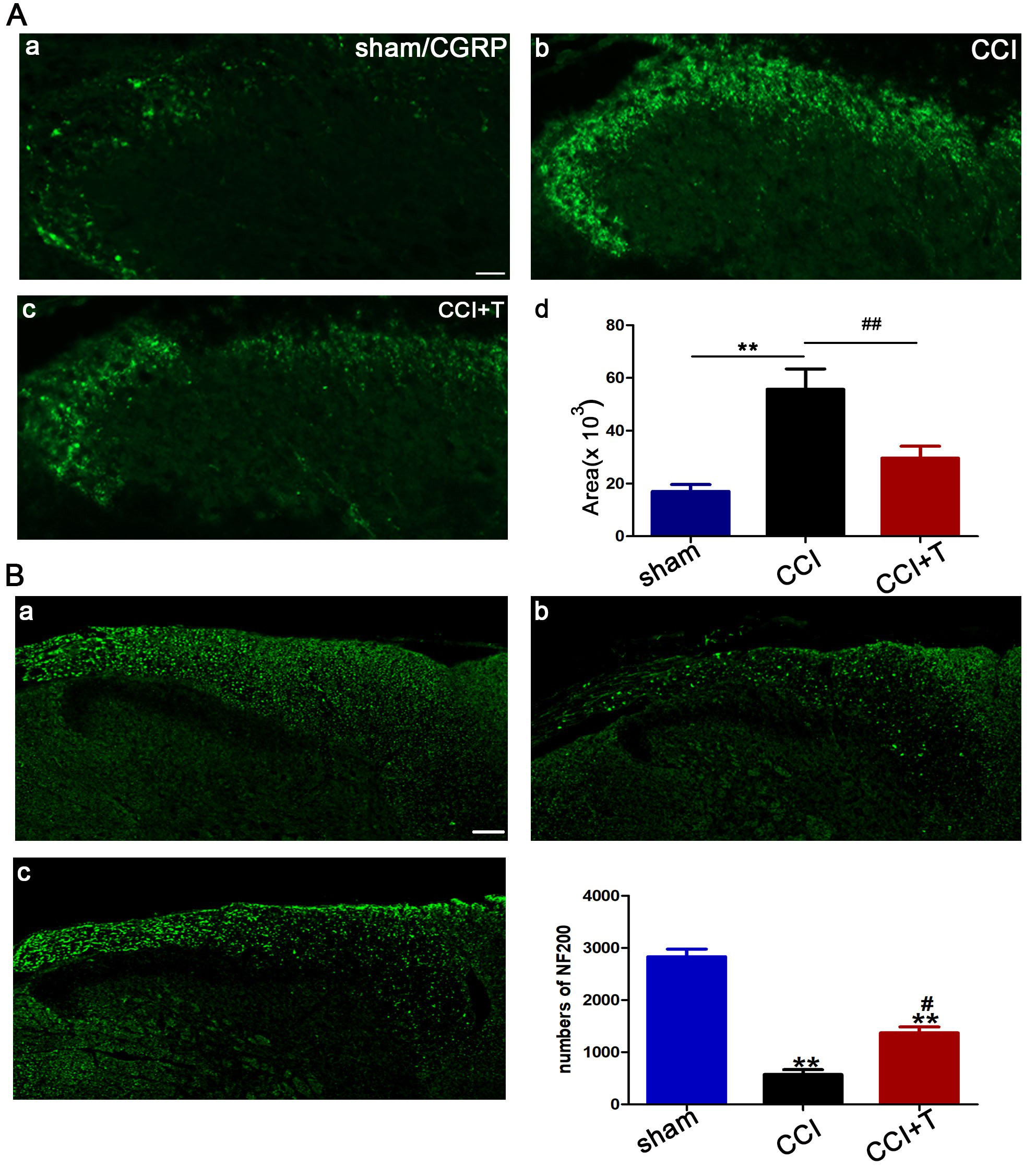 Tacrine changed the expression of CGRP and NF200 after
CCI-injury. (A) Anti-CGRP immunostaining was carried out transverse spinal
sections in sham group (A-a), CCI group (A-b) and CCI + Tacrine group (A-c).
Statistical analysis of integrated density of anti-CGRP fiber in each group (d, n
= 6). (B) Anti-NF200 immunostaining of transverse spinal sections in sham group
(B-a), CCI group (B-b) and CCI + Tacrine group (B-c). Statistical analysis of
numbers of NF200 in each group (n = 6). *p < 0.05, **p < 0.01 versus the sham group; #p < 0.05, ##p <
0.05 versus the CCI group. Scale bars indicated 200 μm.