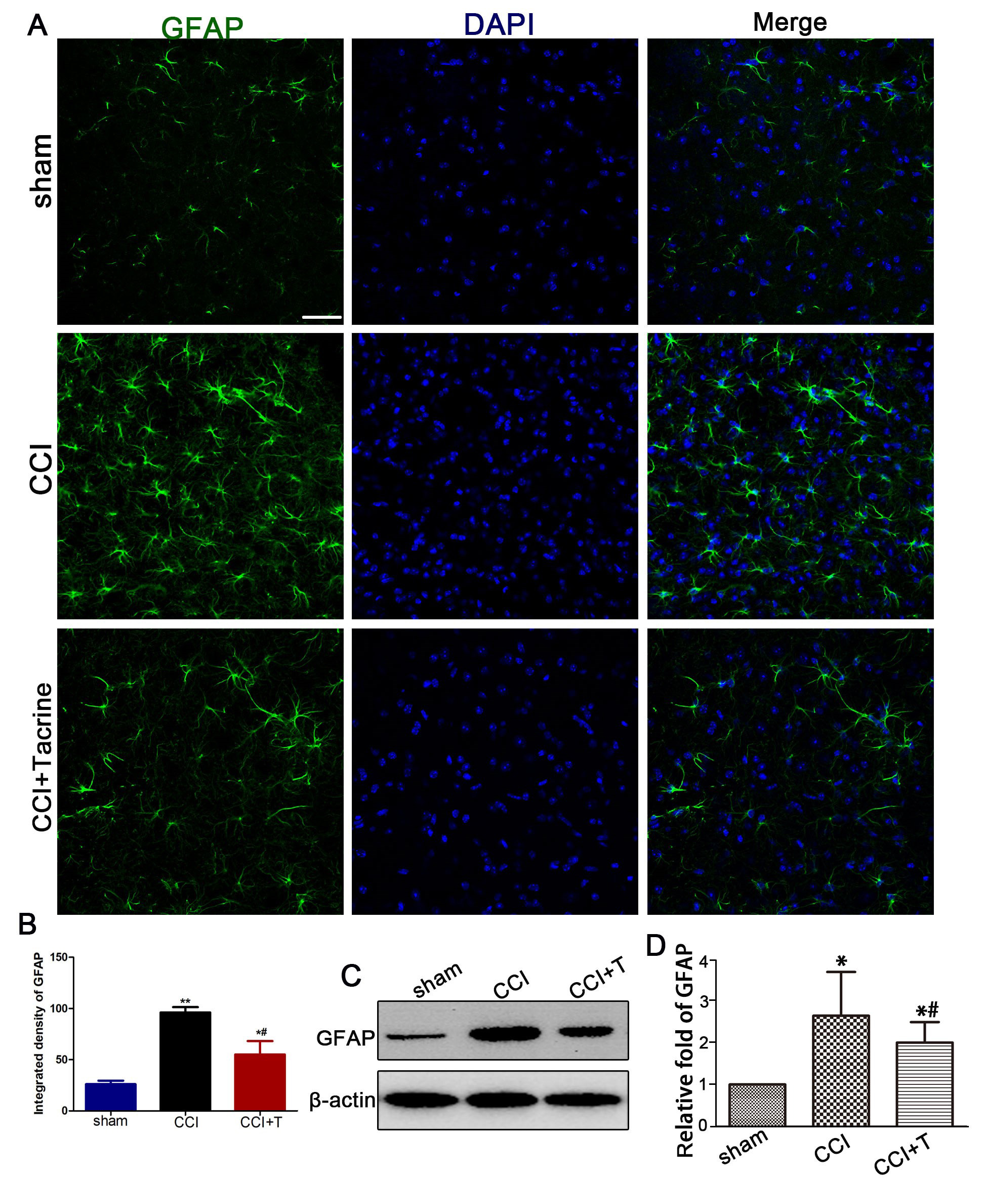 Tacrine depressed the activation of astrocytes after CCI-injury. (A) Representative immunofluorescence staining of the astrocytic marker GFAP and
the nucleus marker DAPI on the ipsilateral spinal cord (scale bar 50T m) in
each group were shown. (B) Statistical analysis of integrated density of GFAP in
each group (n = 6). (C) GFAP expression in spinal cord detected by
western blotting after CCI. (D) Statistical analysis of the differences between
groups (n = 6). *p < 0.05; #p < 0.05, versus the
CCI group.