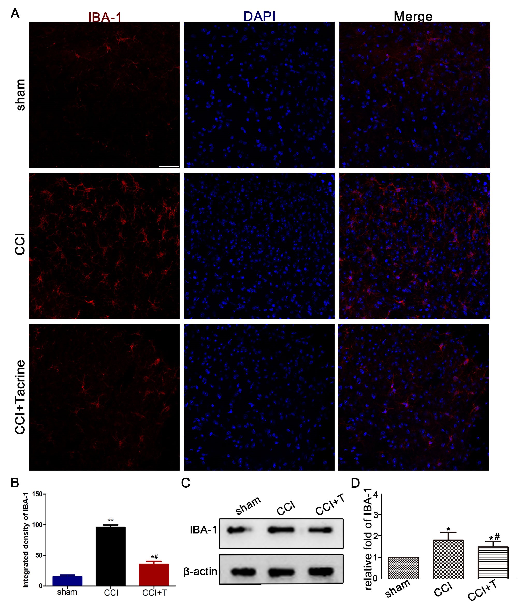 Tacrine decreased the expression of IBA-1 after CCI-injury. (A)
Representative immunofluorescence of the microglial marker IBA-1 on the
ipsilateral spinal cord (scale bar 50 μm) in each group were shown. (B)
Statistical analysis of integrated density of in each group (n = 6).(C)
IBA-1 expression in spinal cord detected by western blotting after CCI. (D)
Statistical analysis of the differences between groups (n = 6). *p < 0.05, **p <0.01 versus the sham group; #p < 0.05,versus the CCI group.