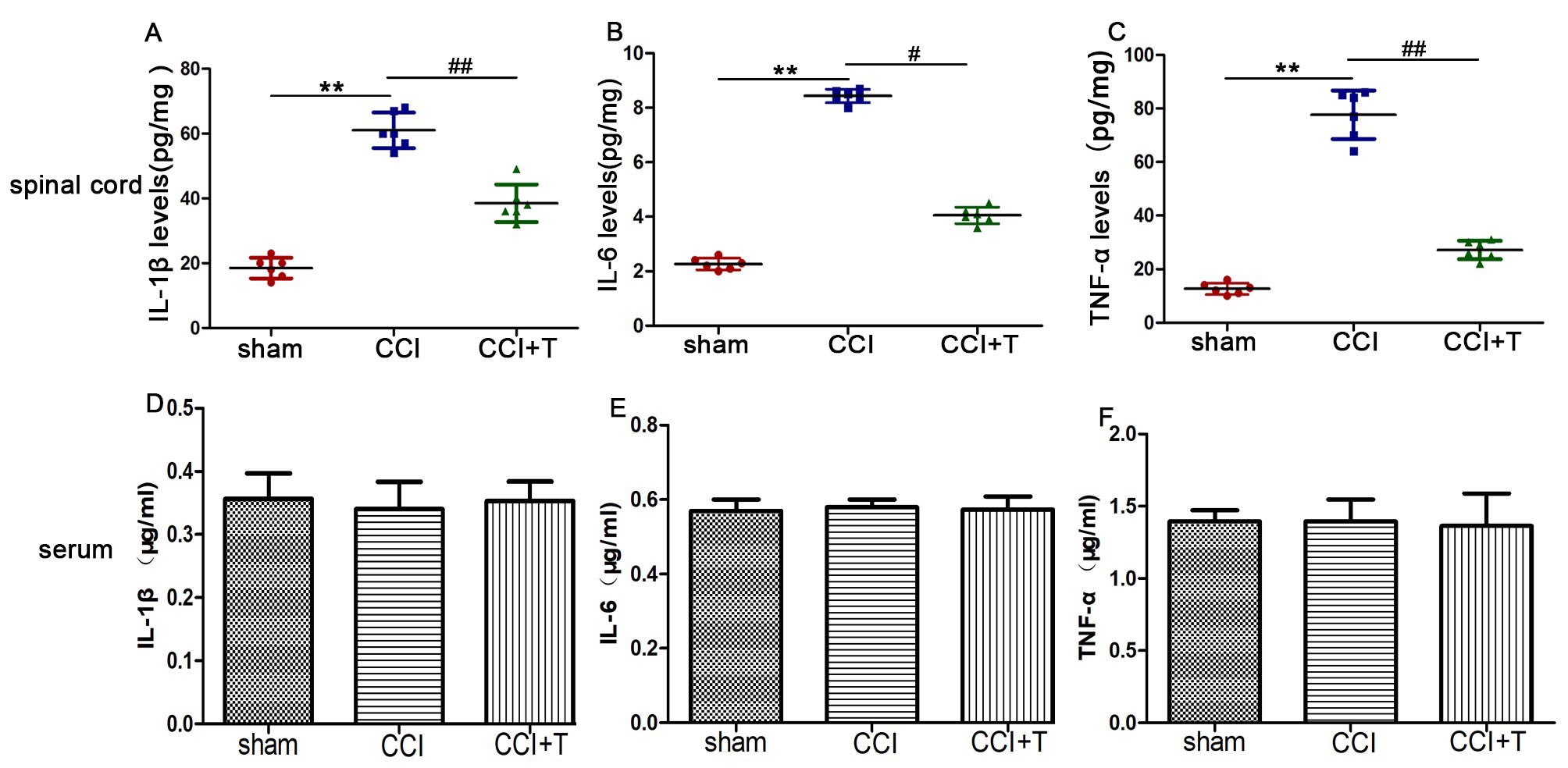 Tacrine decreased the level of IL-1β, IL-6 and
TNF-α in spinal cord but not in serum. (A) Spinal cord level of
IL-1β. (B) Spinal cord level of IL-6. (C) Spinal cord level of
TNF-α. (D) Blood plasma level of IL-1β. (E) Blood plasma of
IL-6. (F) Blood plasma of TNF-α. Values represent mean ± SEM (n =
6). *p < 0.05, **p < 0.01 versus the sham group;
#p < 0.05, versus the CCI group.