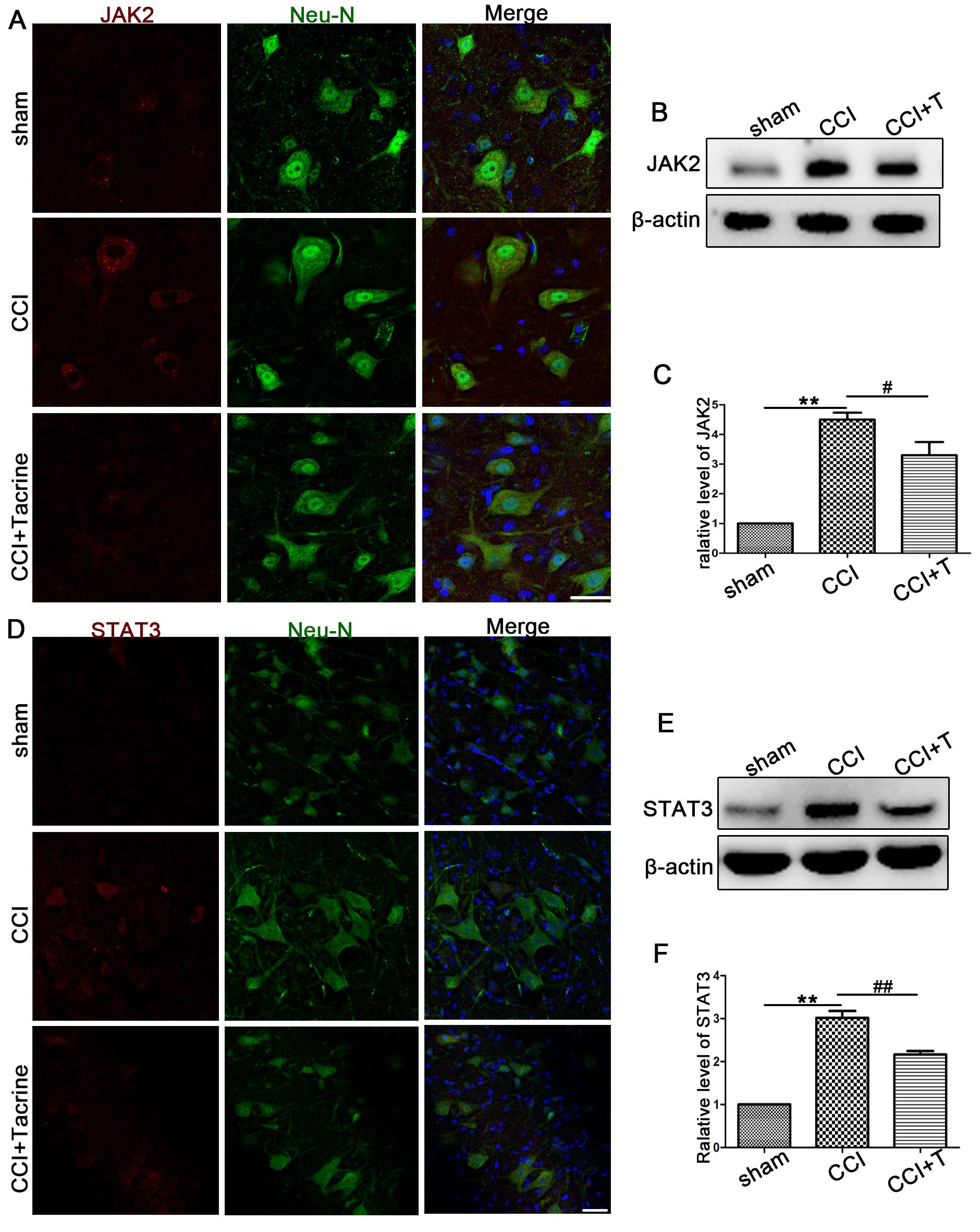 The effect of Tacrine on the expression of JAK2/STAT3 in spinal
cord. (A) Representative immunofluorescence staining of JAK2, the neuron marker
Neu-N and add the nucleus marker DAPI overlay to form Merge (scale bar
50 μm). (B) JAK2 expression in spinal cord detected by western blotting of
each group. (C) Statistical analysis of the protein differences between groups (n
= 6). (D) Representative immunofluorescence staining of STAT3, the neuron marker
Neu-N and add the nucleus marker DAPI overlay to form Merge (scale bar
100 μm). (E) STAT3 expression in spinal cord detected by western blotting of
each group. (F) Statistical analysis of the protein differences between groups (n
= 6).