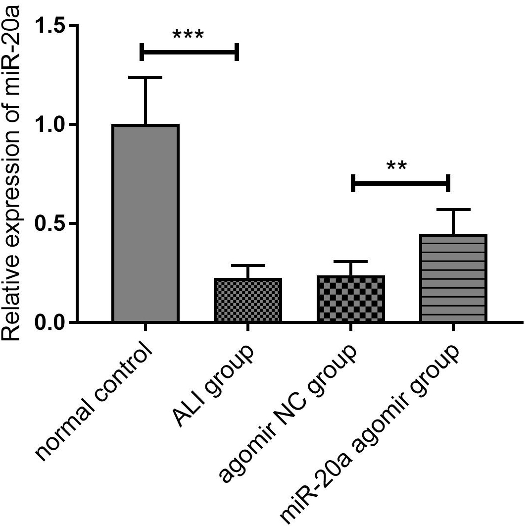 The expression of miR-20a in different groups. qRT-PCR was used 
to detect the expression of miR-20a in ALI, miR-20a agomir group and their 
controls. n = 6 in each group. Data were expressed as mean ± SD. ** 
p < 0.01 and *** p < 0.001 represent statistically 
difference.