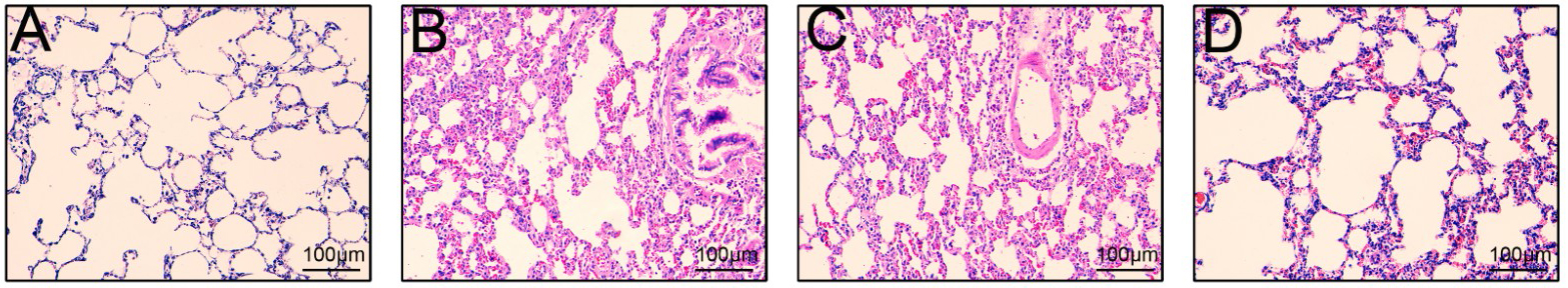 Effect of miR-20a on pathological morphology of lung tissue (HE 
× 200). The lung tissue of rats with sepsis was fixed with 10% 
formaldehyde, and the pathological changes were observed by HE staining after 
paraffin embedding. The lung tissue appearance of rats in normal control (A), ALI 
group (B), agomir NC group (C) and miR-20a agomir group (D). n = 6 in each group. 
Data were expressed as mean ± SD.