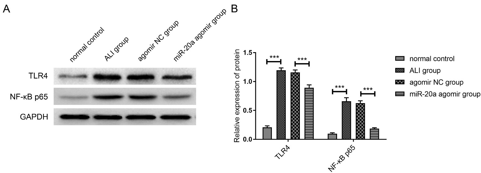 miR-20a inhibits the expression of TLR4 and NF-κB p65 
in rat lung tissue. (A) The expressions of TLR4, NF-κB p65 and GAPDH in 
normal control, ALI group, agomir NC group and miR-20a agomir group were detected 
by Western blot. (B) Alpha Imager HP gel imaging system was used to analyze the 
relative protein expression levels of TLR4 and NF-κB p65 in lung tissues 
in four groups. n = 6 in each group. Data were expressed as mean ± SD. **p < 0.01 and *** p < 0.001 represent 
statistically difference.