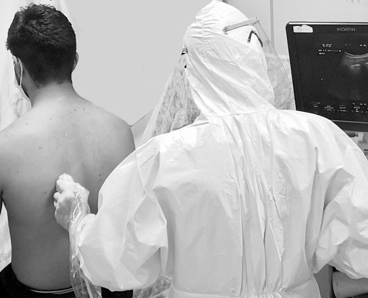 Covered cables and the probe were put in a sterile gloves, helt
by sonographer.