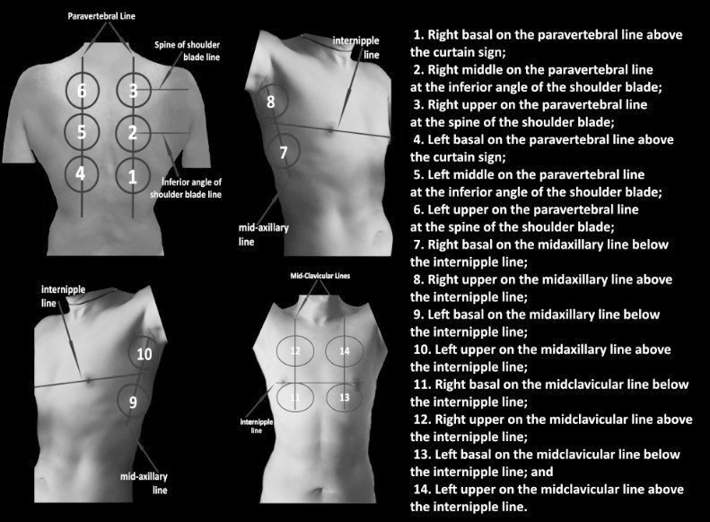 Fourteen areas of ultrasonographic examination.