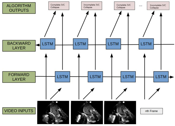 Shows the LSTM architecture developed and employed in the 
study.