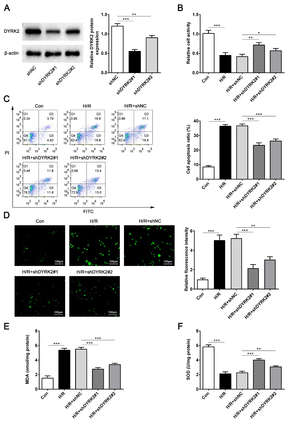 Alteration of DYRK2 expression reversed cardiomyocyte injury
induced by H/R. Cardiomyocytes were transfected with shNC, shDYRK2#1 or
shDYRK2#2. (A) DYRK2 protein was examined by Western blot analysis. (B) MTT
assay was used to detect the cell viability of each group. (C) Cardiomyocyte
apoptosis was assessed using flow cytometry methods. (D) Intracellular ROS
generation was measured by DCFH-DA. (E) Detection of MDA expression level. (F)
Detection of SOD expression level. *** p < 0.001 vs. Control or shNC
or H/R + shNC. ** p < 0.005 vs. shNC or or H/R + shNC. * p< 0.05 vs. H/R + shNC. Data are expressed as mean ± SD.