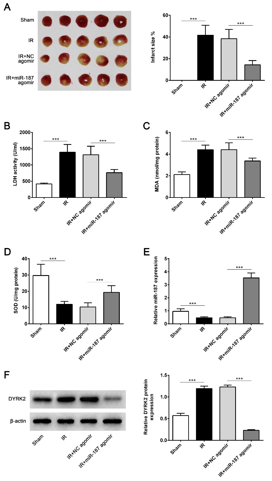 Overexpression of miR-187 suppressed ischemia/reperfusion
induced myocardial infarct in vivo. The mice were received the
over-expression vectors of miR-187 agomir or NC agomir. (A) Representative
crosssectional images of I/R (ischemia 30 min, reperfusion 24 h) heart with TTC
n = 10. (B) Detection of serum lactate dehydrogenase (LDH) level. (C) Detection
of MDA expression level. (D) Detection of SOD expression level. (E) The
expression level of miR-187 in vivo was measured by qRT-PCR. (F) The expression
of DYRK2 was measured by western blot. *** p < 0.001 vs. Sham or I/R +
NC agomir. Data are expressed as mean ± SD.