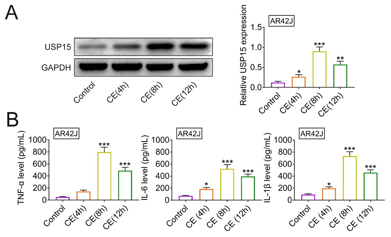Elevated USP15 in cerulein-treated AR42J cells.(A) Protein expression of USP15 in AR42J cells post cerulein treatment for 4, 8,
or 12 hours.
(B) Expression of TNF-α, IL-6 and IL-1β in AR42J cells post
cerulein Treatment for 4, 8, or 12 hours. *, **, *** vs. control, p <
0.05, p < 0.01, p < 0.001.