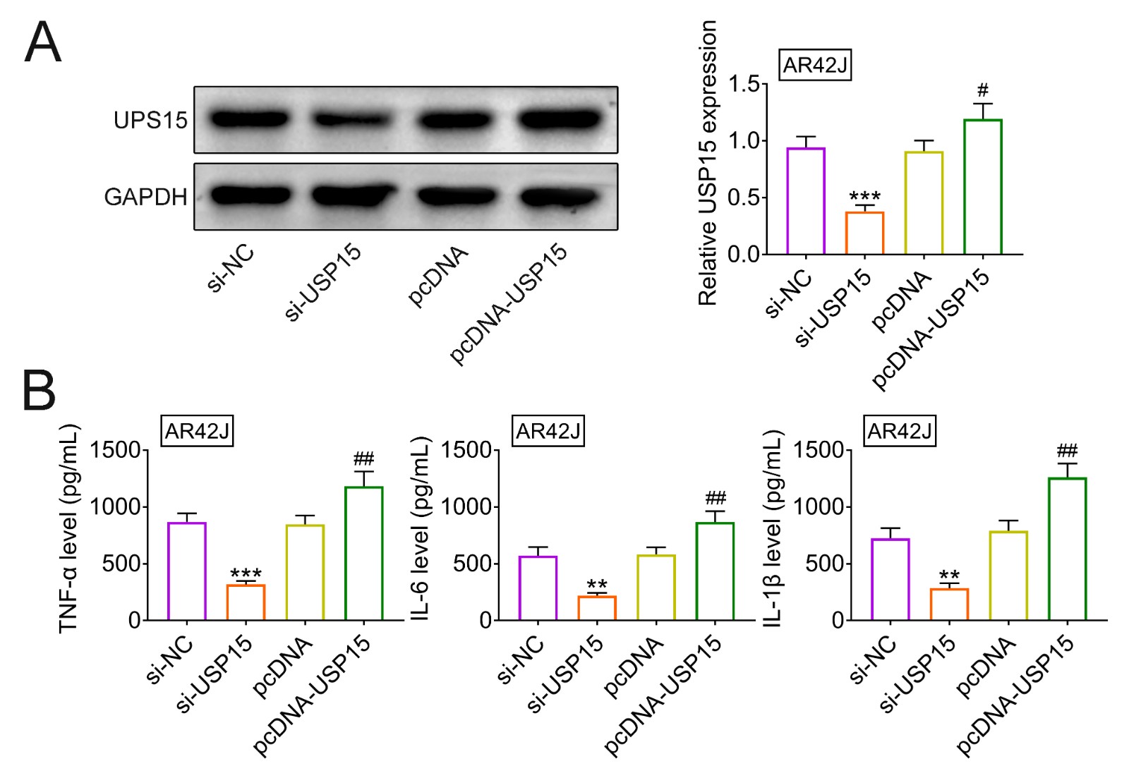USP15 contributed to cerulein-induced inflammation in AR42J
cells.(A) Protein expression of USP15 in cerulein-treated AR42J cells transfected with
si-USP15 or pcDNA-USP15.
(B) Silence of USP15 reduced TNF-α, IL-6 and IL-1β expression
in cerulein-treated AR42J, while over-expression of USP15 enhanced the
TNF-α, IL-6 and IL-1β production. **, *** vs. si-NC, p< 0.01, p < 0.001. #, ## vs. pcDNA, p < 0.05,
p < 0.01.