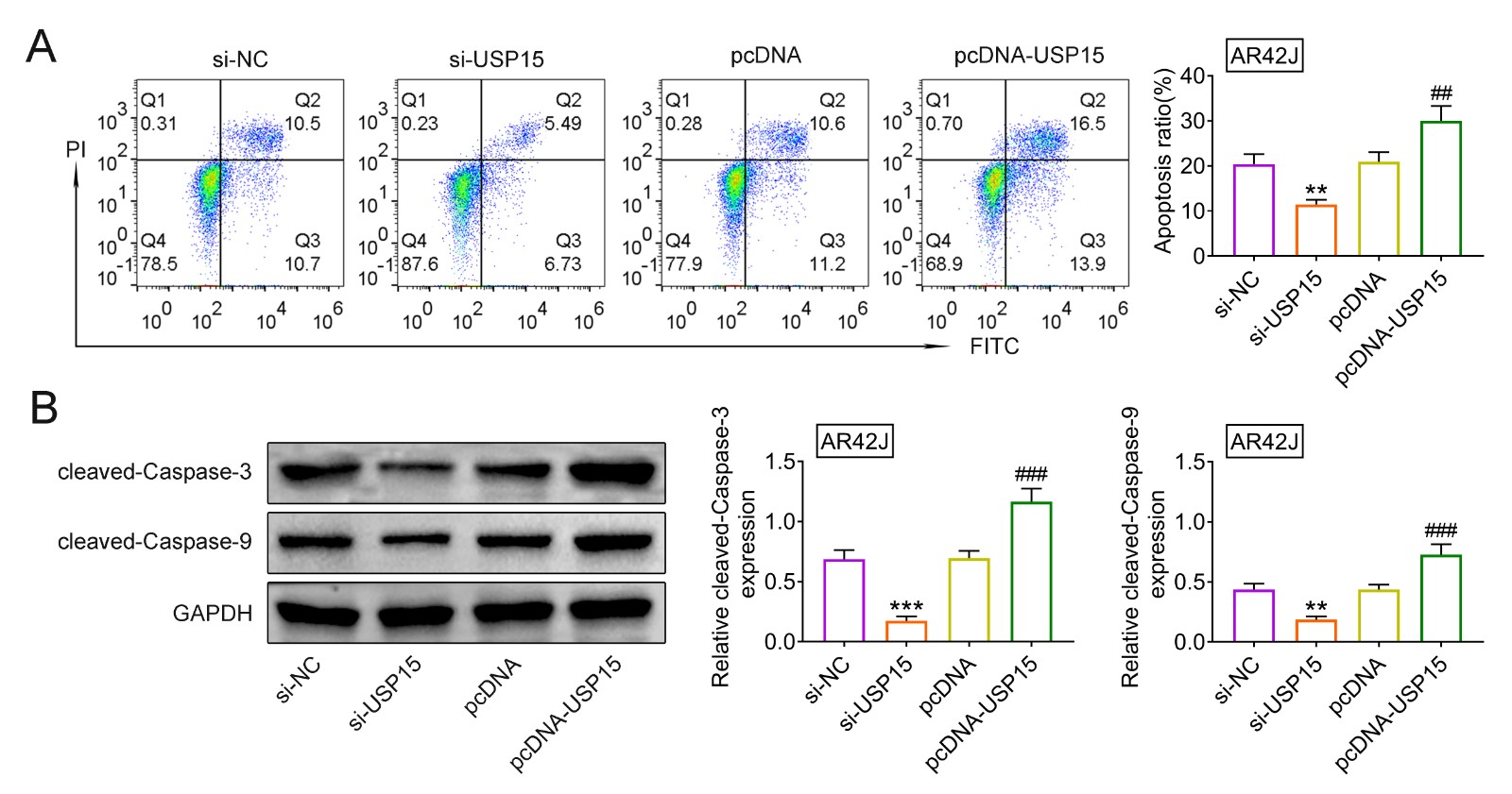 USP15 contributed to cerulein-induced apoptosis in AR42J cells.(A) Cell apoptosis of cerulein-treated AR42J cells with silence and
over-expression of USP15.
(B) The expression of cleaved caspase-3 and cleaved caspase-9 in
cerulein-treated AR42J cells with silence and over-expression of USP15. **, ***
vs. si-NC, p < 0.01, p < 0.001. ##, ### vs. pcDNA,
p < 0.01, p < 0.001.
