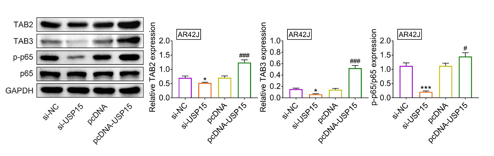 USP15 contributed activation of TAB2/3-NF-κB in
cerulein-treated AR42J cells.The expression of TAB2, TAB3, p-p65 in cerulein-treated AR42J cells with silence
and over-expression of USP15. *, *** vs. si-NC, p < 0.05, p< 0.001. #, ### vs. pcDNA, p < 0.05, p < 0.001.