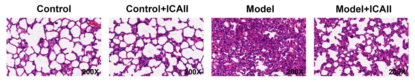 Icariside II alleviates LPS-induced lung injury in mice. The
histological changes of lung tissue in Control, Model, Control+ 20 mg/kg
Icariside II, Model+ 20 mg/kg Icariside II groups.