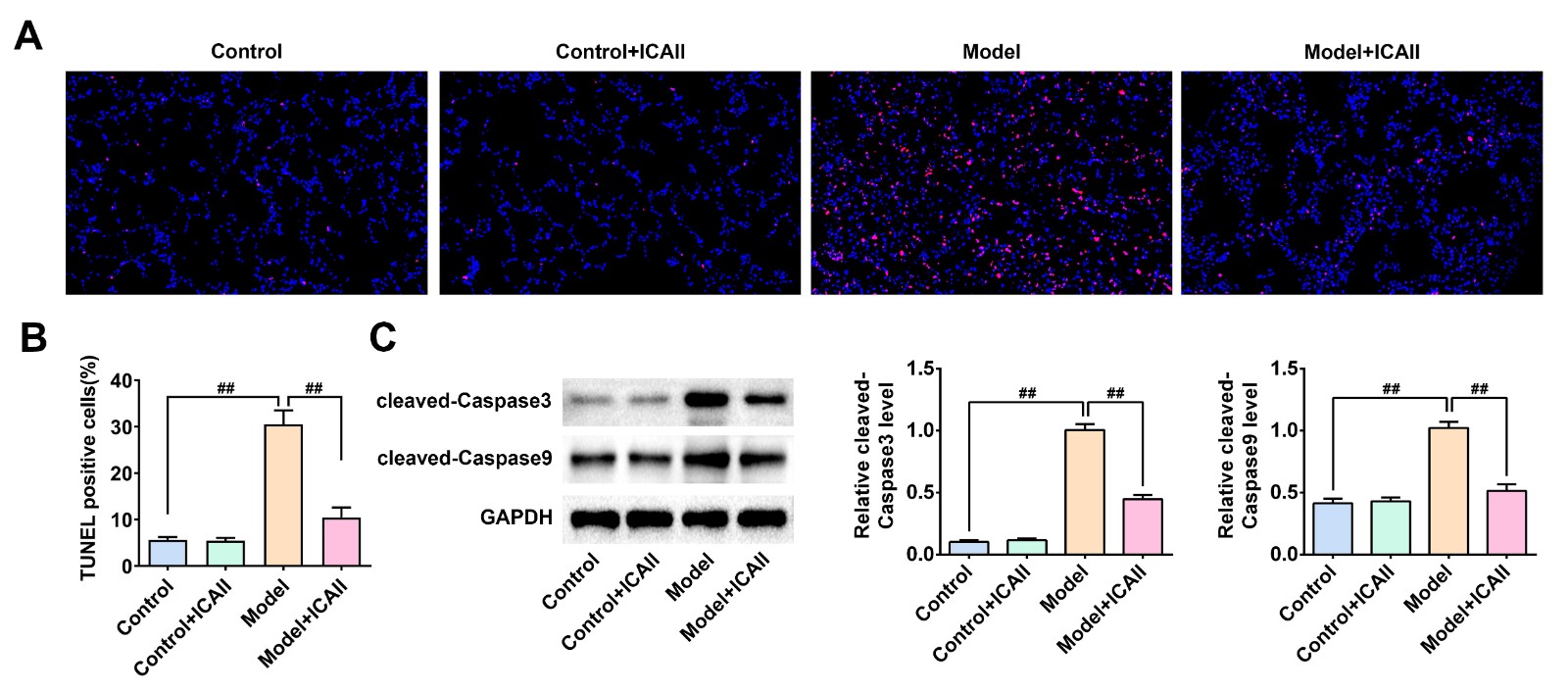 Icariside II suppresses the apoptosis of lung cells in mice with
lung injury. (A,B) TUNEL assay showed the apoptosis degrees of lung cells upon
the indicated treatment. (C) Immunoblot assay detected the protein level of
Cleaved caspase-3, cleaved caspase-9, and GAPDH in Control, Model, Control+ 20
mg/kg Icariside II, Model+ 20 mg/kg Icariside II groups. Data are displayed as
mean ± SD. ##, p < 0.01.