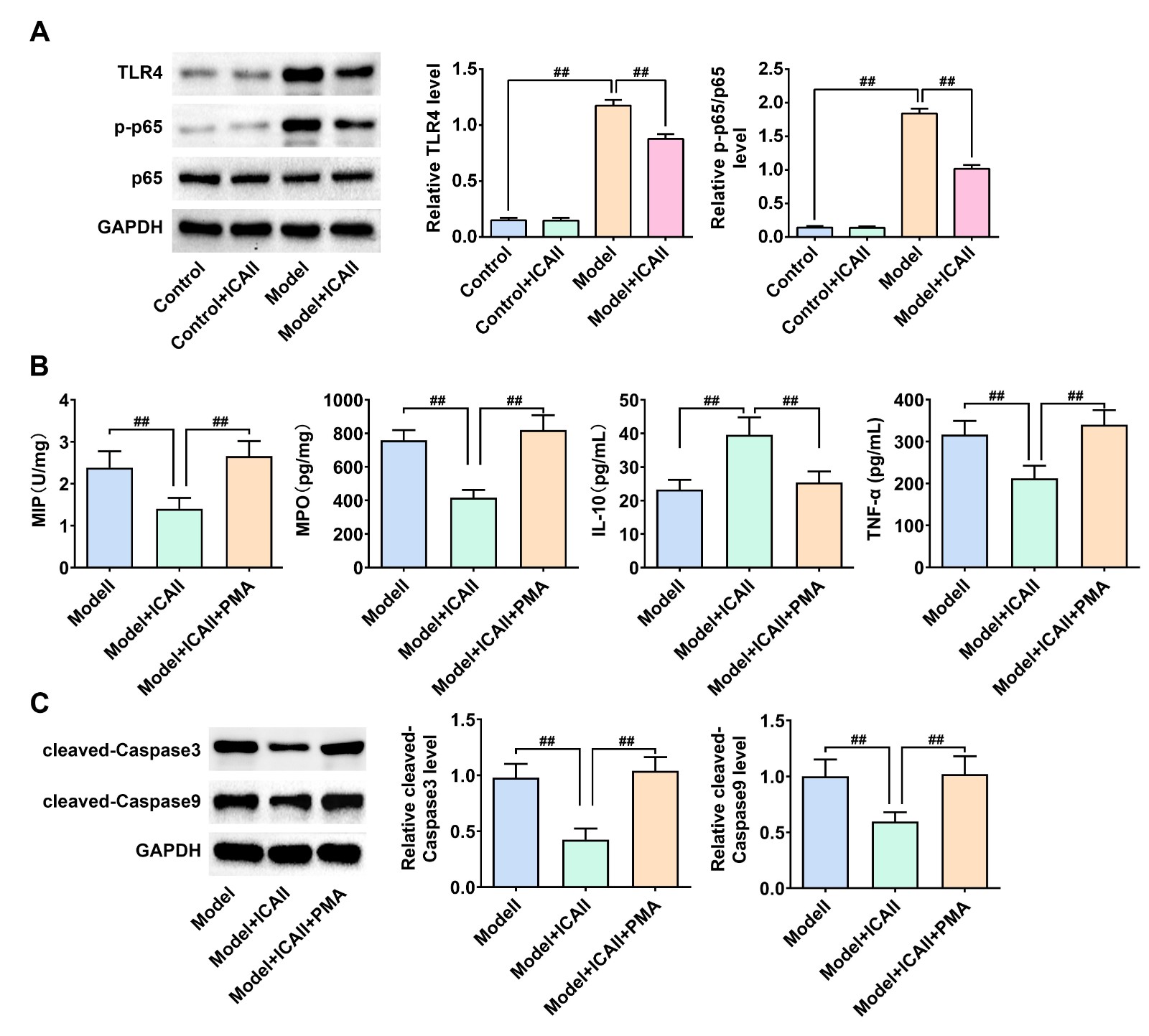 Icariside II affected TLR4-NF-κB pathway in mice with
lung injury. (A) Immunoblot assay detected the protein level of TLR4, p-p65,
p65, and GAPDH in Control, Model, Control+ 20 mg/kg Icariside II, Model+ 20 mg/kg
Icariside II groups. (B) ELISA assays showed the levels of MIP, MPO, IL-10, and
TNF-α levels in lung tissues from the indicated groups. (C) Immunoblot
assays showed the expression of cleaved caspase-3 and cleaved caspase-9 in lung
tissues from the indicated groups. Data are displayed as mean ± SD. ##,
p < 0.01.