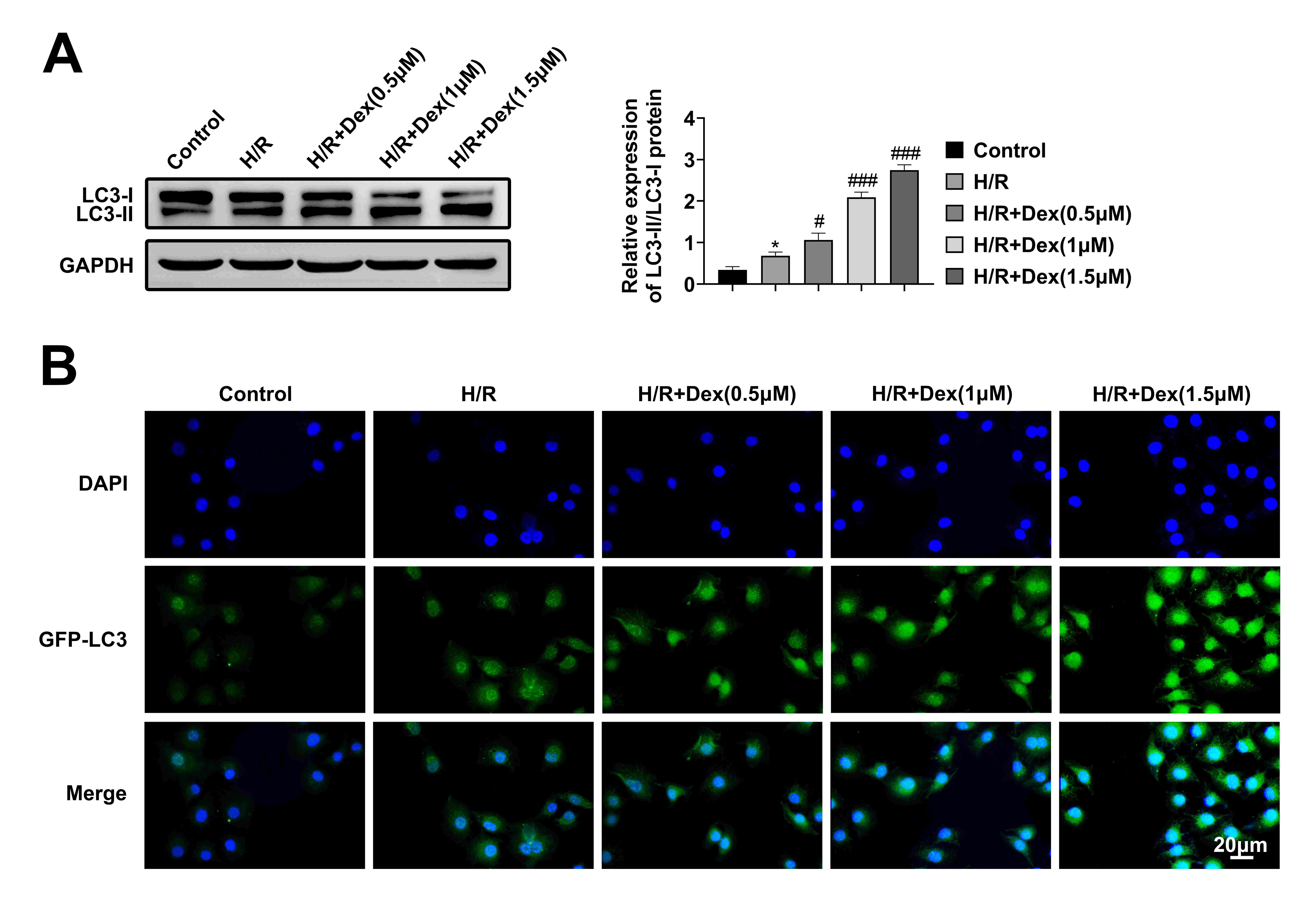 DEX worsened autophagy in H/R caused H9c2 cells. (A)
LC3-II/LC3-I protein level was tested with western-blot assay. (B) LC3 expression
level in each group was examined with immunofluorescence in H9c2 cells. Data was
reported as mean ± SD. ∗p < 0.05, vs. control
group.♯p < 0.05, ♯♯p < 0.01 and♯♯♯p < 0.001, vs. H/R group.