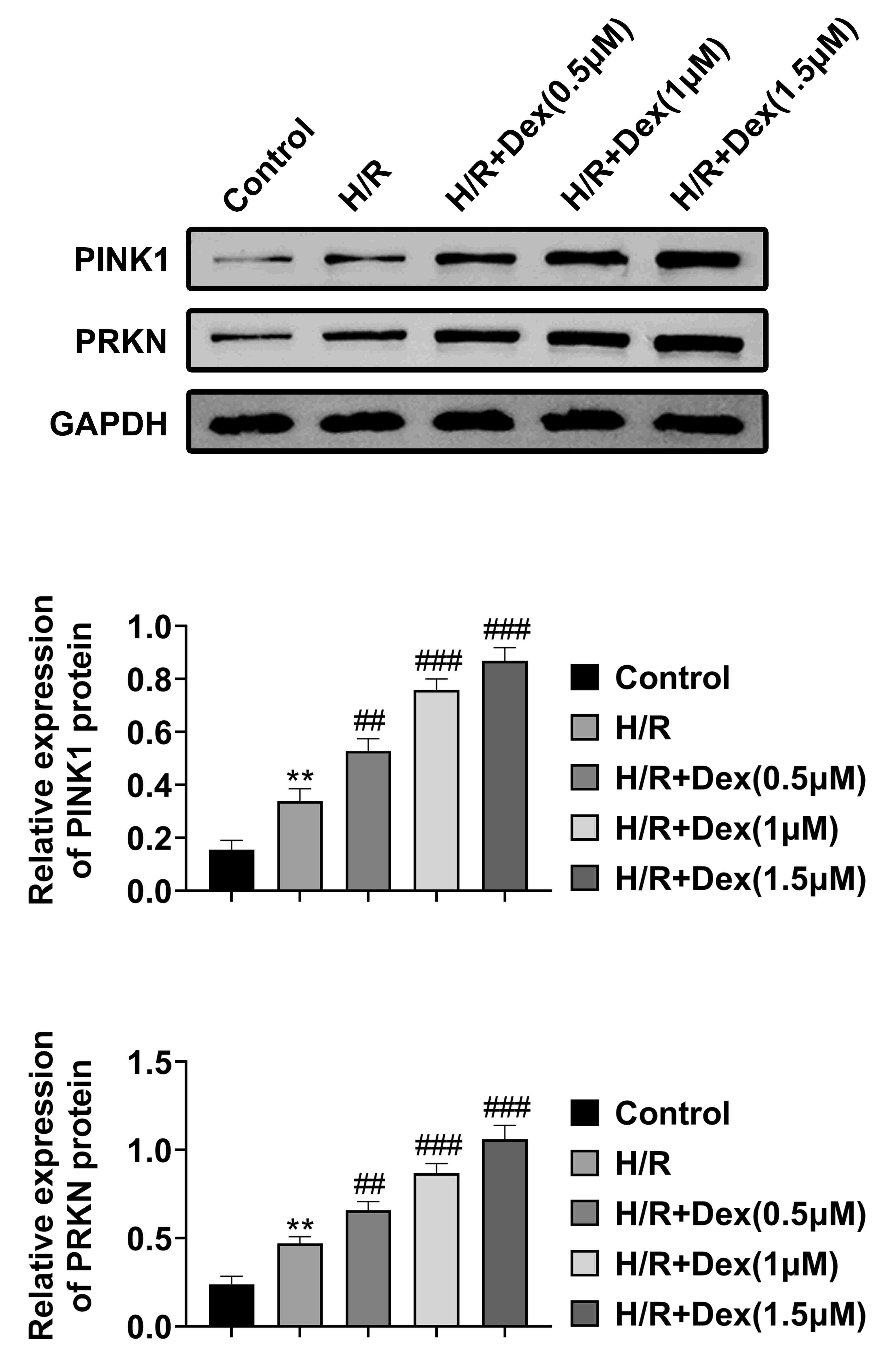 DEX increased PINK1 and PRKN expression in H9c2 cells. PINK1
and PRKN protein levels were assessed by western-blot test in H9c2 cells. Data
were reported as mean ± SD. ∗∗p < 0.01, vs.
control group. ♯♯p < 0.01 and ♯♯♯p < 0.001,
vs. H/R group.