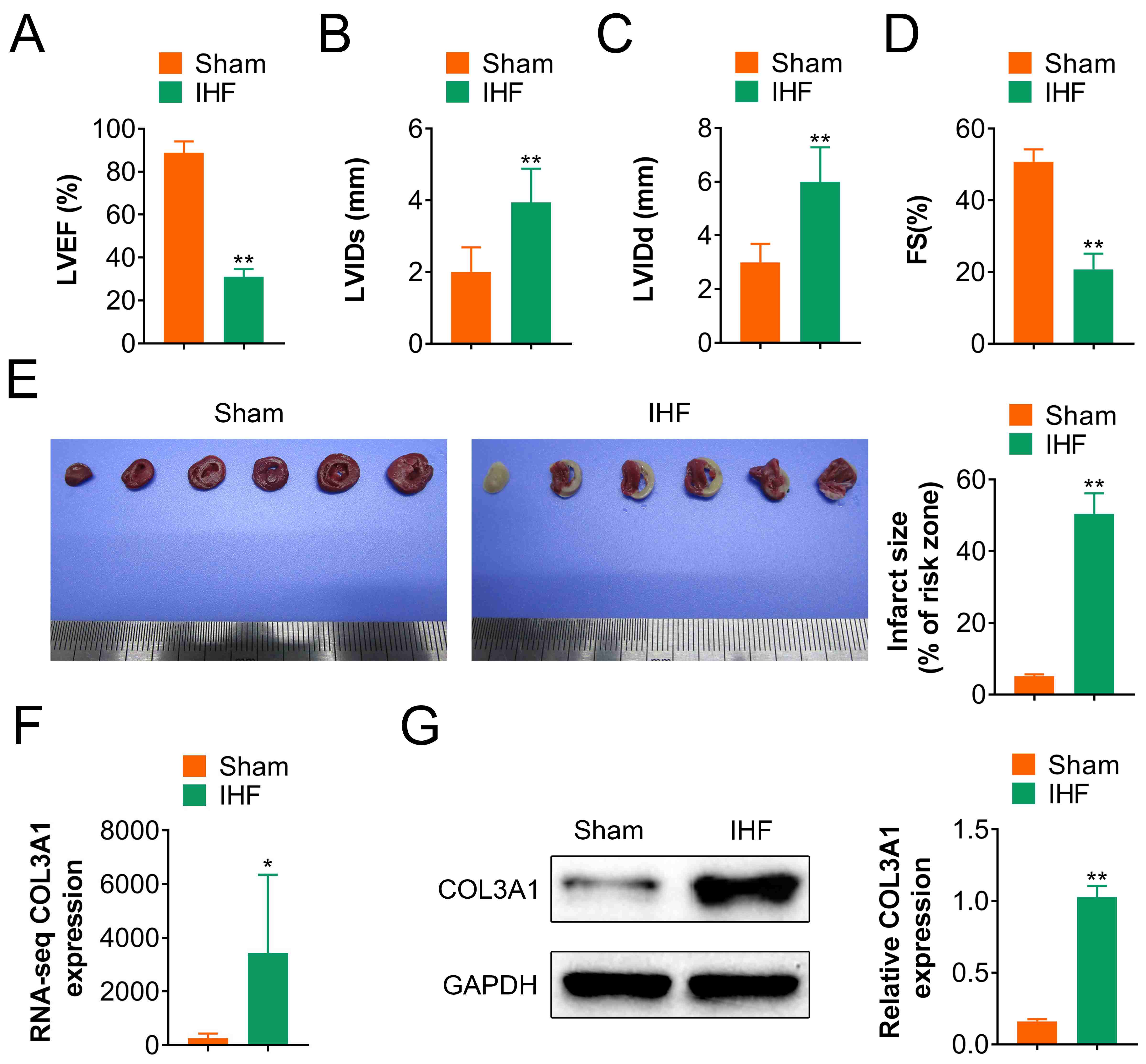 COL3A1 is significantly up-regulated in 
myocardial cells from rats with IHF. (A–D) Rats were divided into sham group 
and IHF group. Echocardiography analysis of cardiac function index (4 weeks after 
surgery), including Left ventricular ejection fraction (LVEF), left ventricular 
end systolic diameter (LVIDs), left ventricular end systolic volume (LVIDd), and 
left ventricular shortening fraction (LVFS). (E) TCC staining analysis of 
myocardial infarction size in IHF rats. (F) The mRNA expression of COL3A1 
 (type III collagen) was analyzed by RNA-sequencing. (G) Western blotting assay of 
COL3A1 protein expression. Data are representative of three independent 
experiments (mean ± SD). *, p < 0.05 and **, p < 
0.01. vs. Sham group. IHF: ischemic heart failure.
