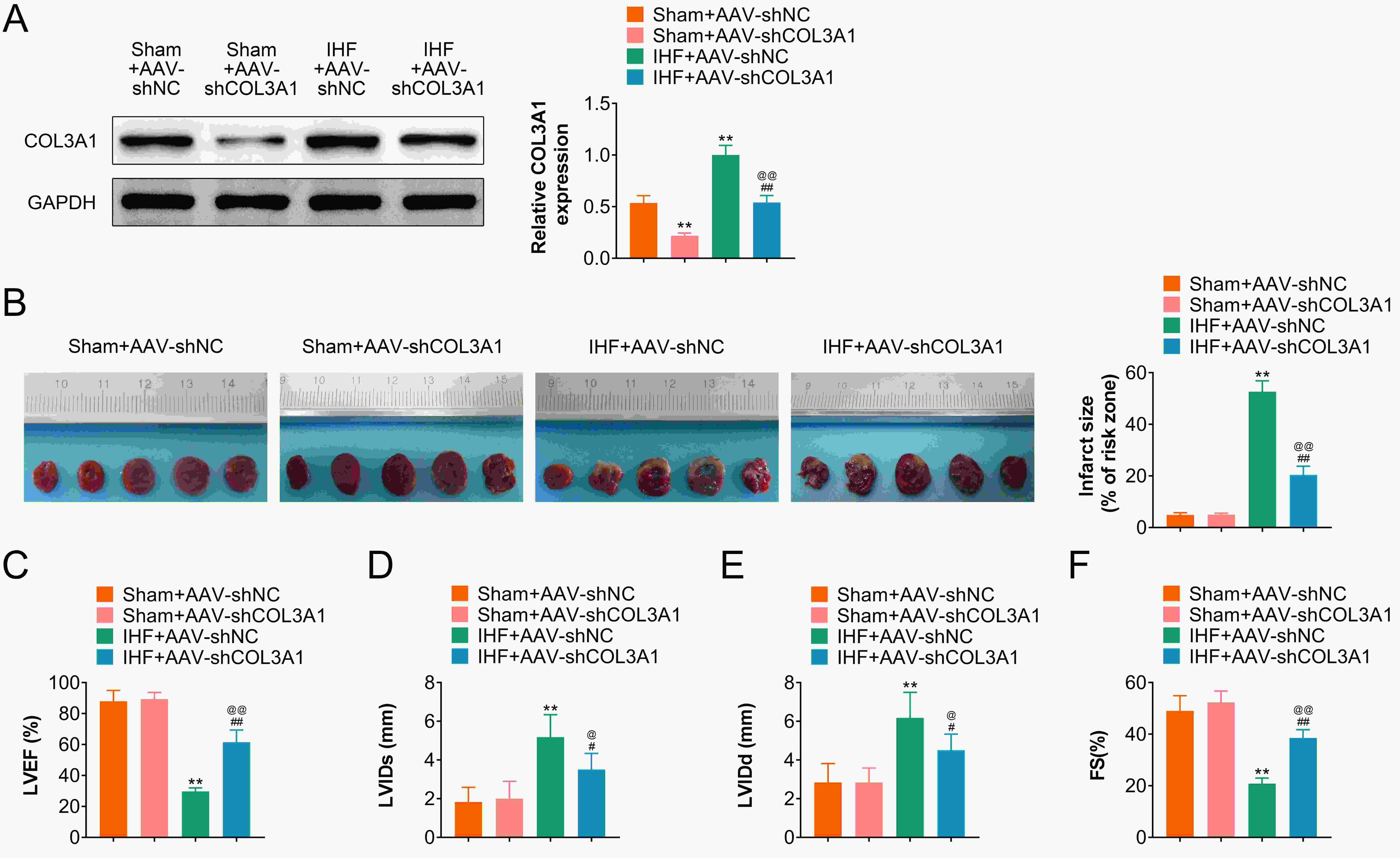 Knockdown of COL3A1 alleviates myocardial cell damage 
in rats with IHF. (A) Knockdown COL3A1-AAV (Adeno-associated virus) 
plasmid through tail vein injection of sham or IHF model, the expression of 
COL3A1 was measured by western blotting. (B) TCC staining analysis of 
the myocardial infarction size in IHF rats with COL3A1-AAV plasmid 
treatment. (C–F) Echocardiography analysis of cardiac function index in IHF rats 
with COL3A1-AAV plasmid treatment (4 weeks after surgery), including 
Left ventricular ejection fraction (LVEF), left ventricular end systolic diameter 
(LVIDs), left ventricular end systolic volume (LVIDd), left ventricular 
shortening fraction (LVFS). **, p < 0.01 vs. Sham + AAV-shNC 
group. #, p < 0.05 and ##, p < 0.01. 
vs. IHF + AAV-shNC group. @, p < 0.05 and @@, 
p < 0.01. vs. Sham + AAV-shCOL3A1 group. IHF: 
ischemic heart failure.