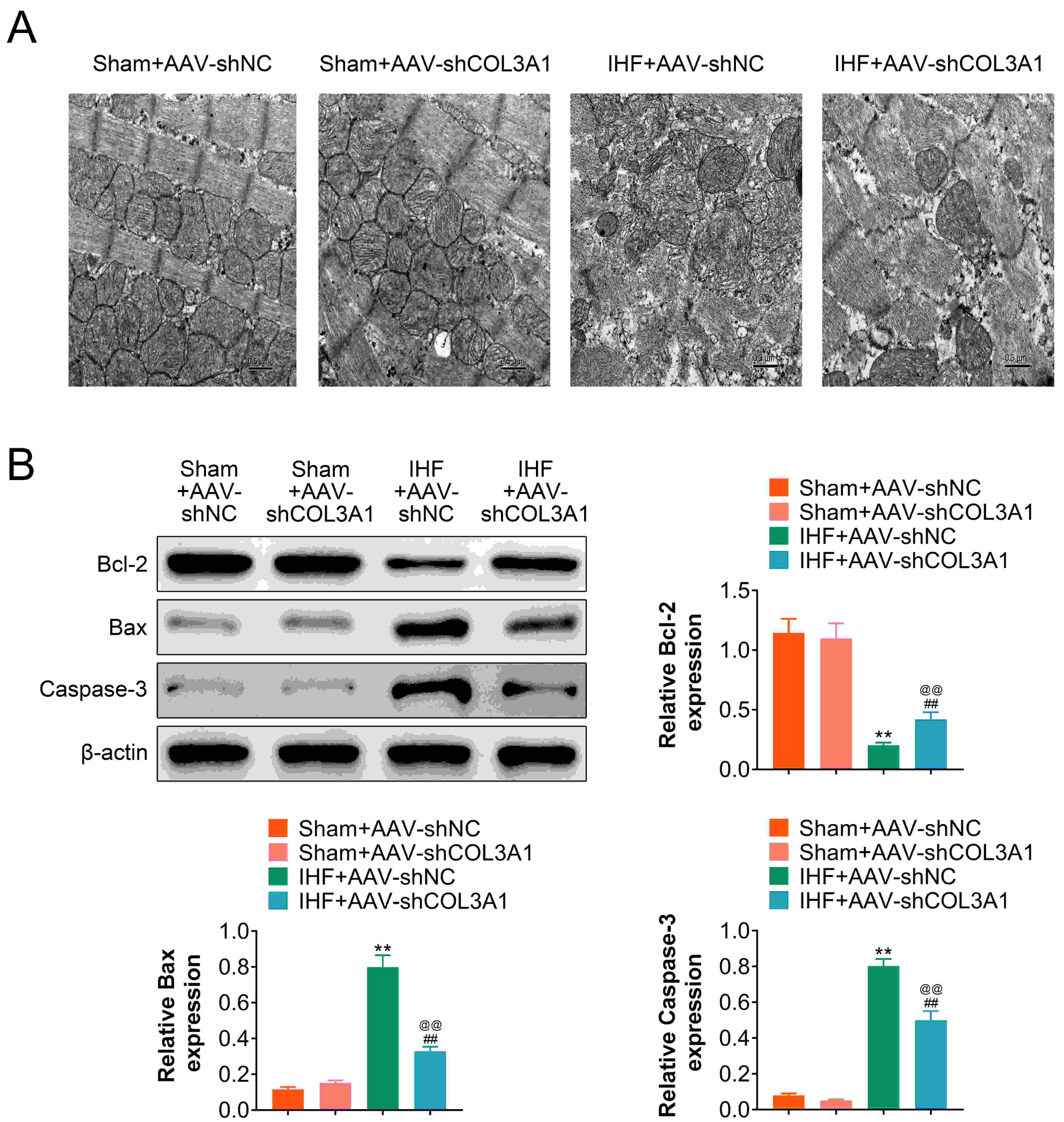 Knockdown of COL3A1 inhibits apoptosis of 
cardiomyocytes in rats with IHF. (A) TEM assay analysis of cell apoptosis from 
IHF rats with COL3A1-AAV (Adeno-associated virus) plasmid treatment. (B) 
The western blotting assay determined the expressions of Bcl-2, Bax, and 
Caspase-3 in IHF rats with COL3A1-AAV plasmid treatment. **, p 
< 0.01 vs. Sham + AAV-shNC group. ##, p < 0.01. 
vs. IHF + AAV-shNC group. @@, p < 0.01. vs. 
Sham + AAV-shCOL3A1 group. IHF: ischemic heart failure.