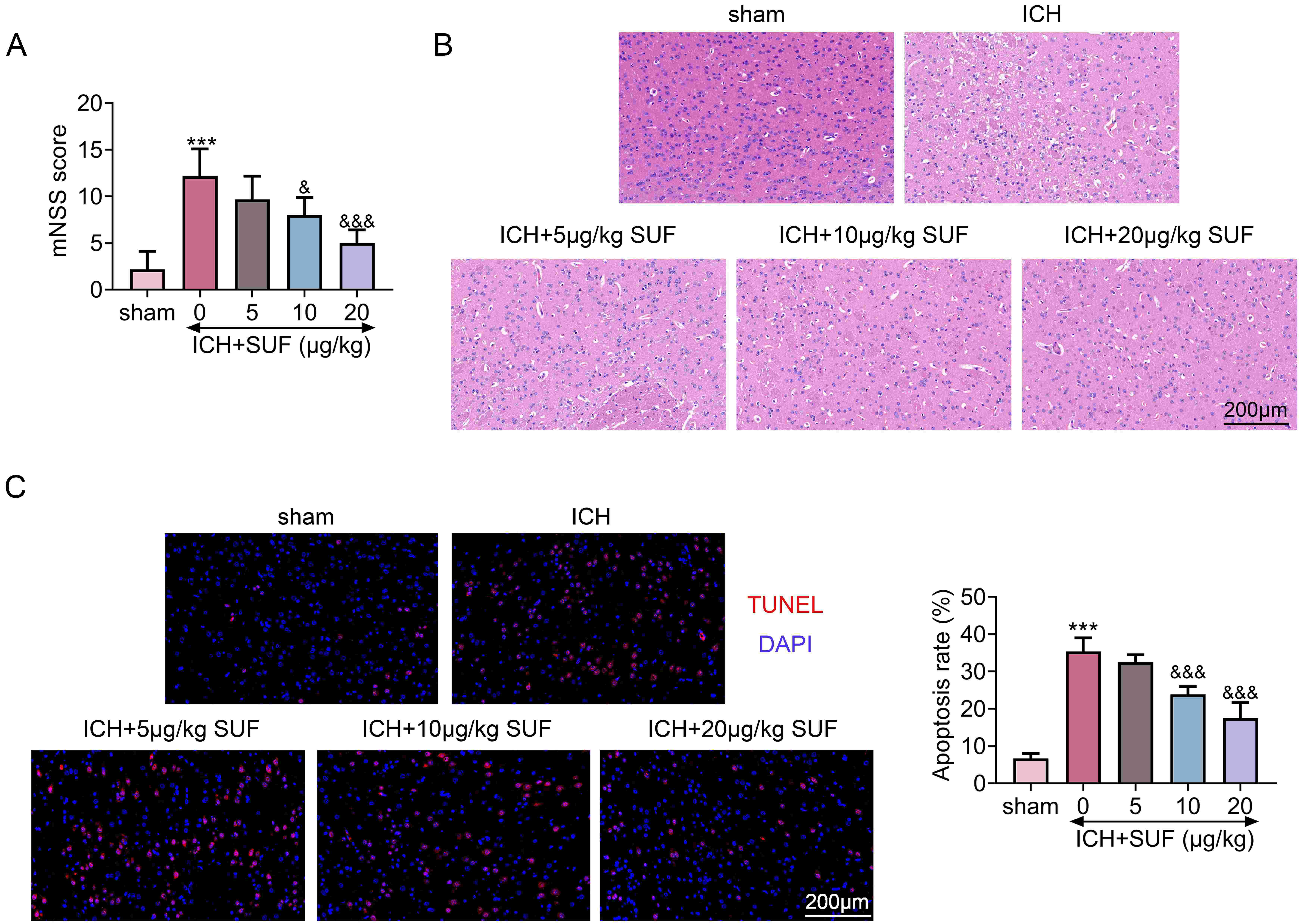 Sufentanil ameliorated histological damages of rats with ICH. (A) Sufentanil attenuated collagenase injection-induced increase of mNSS score in
rats to attenuate behavioral deficits. N = 12. (B) Sufentanil attenuated
intracerebral hemorrhage with mass effects to right lateral ventricle and corpus
callosum in rat model of ICH induced by collagenase injection. N = 12. (C)
Sufentanil reduced the neuronal apoptosis of rats with ICH. N = 12. ***
vs. sham, p < 0.001. &, &&&vs. ICH,
p < 0.05, p < 0.001. ICH: intracerebral hemorrhage; mNSS:
modified neurological severity scores; TUNEL: transferase dUTP nick-end labeling;
SUF: Sufentanil; DAPI: 4′,6-diamidino-2-phenylindole.