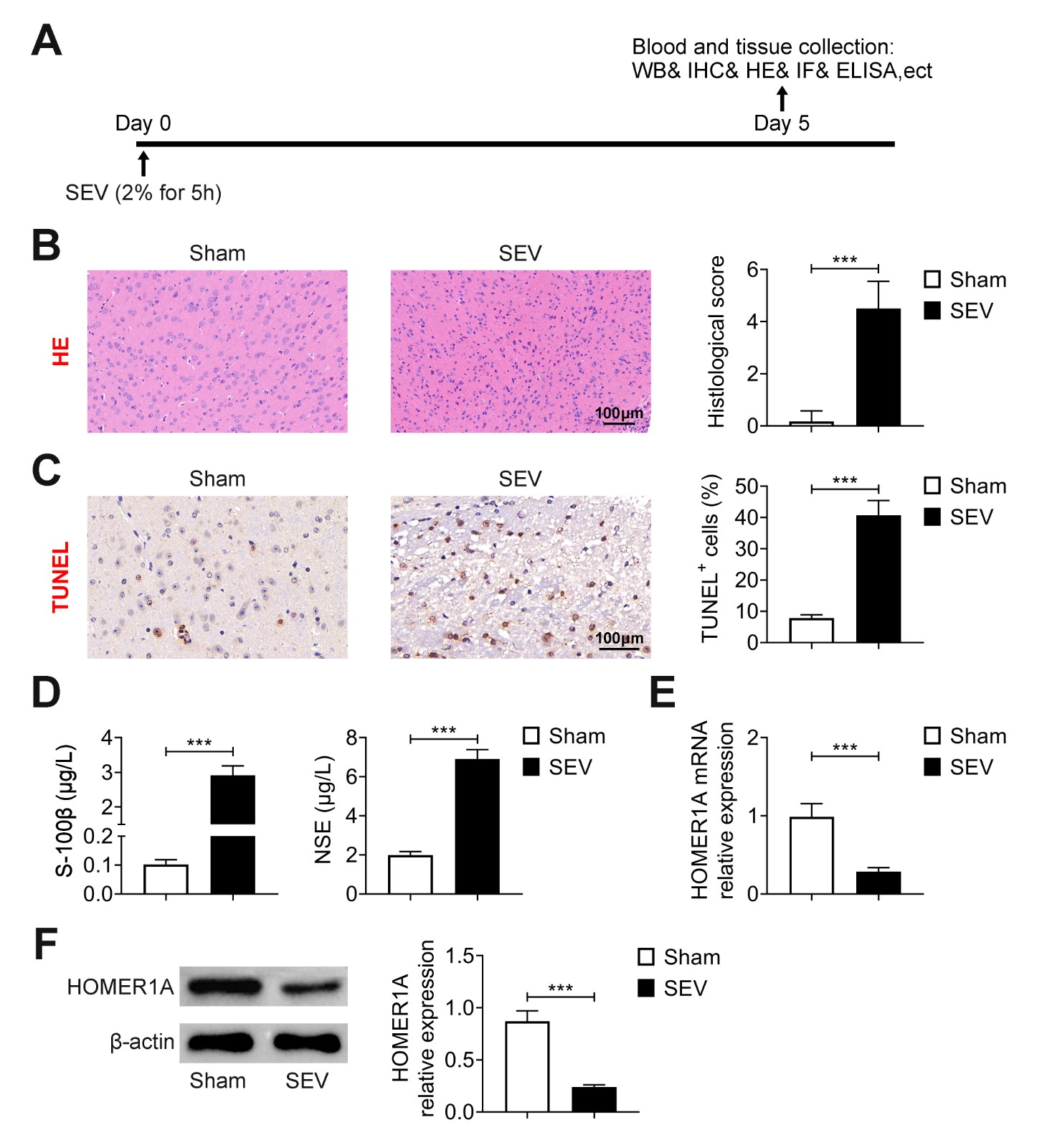 HOMER1A exhibited
lower expression in the brain tissues of SEV-induced rats. (A) The schematic of
the timeline was showed. SEV (2% for 5 h) was treated to rats at Day 0, and rats
were killed at Day 5 to collect the blood and tissues for next experiments. (B)
The damage of brain tissues in rats was detected in the Sham and SEV groups
through H&E staining. (C) The cell apoptosis was measured in the Sham and SEV
groups through TUNEL staining. (D) The levels of
S-100β and NSE were assessed through ELISA. (E,F) The mRNA and protein expressions of HOMER1A were examined
through RT-qPCR and western blot. Six rats were used in each group. ***p < 0.001. SEV: Sevoflurane; NSE: neuron-specific enolase.