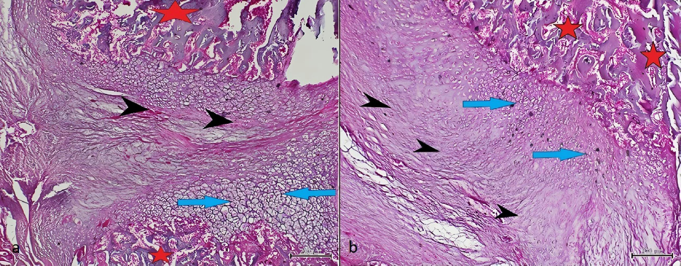 Third week histological sections, black arrows indicate fibrous
tissue; blue arrows indicate cartilage tissue, and asterisks indicate immature
bone tissue. In Groups A, common fibrous tissues and cartilage areas are observed
at the fracture line (a). In Groups B, which did not undergo splenectomy,
fibrous, cartilage tissue and immature bone areas are observed together (b).