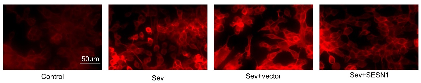 SESN1 improves sevoflurane induced oxidative stress.
Immunostaining assays showed the ROS levels of cells upon the treatment of SEV or
SESN1 plasmids. Scale bar indicates 50 µm. SESN1: Sestrin 1; SEV:
sevoflurane.