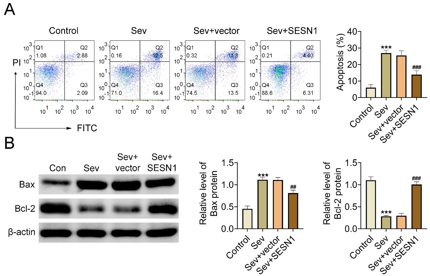 SESN1 inhibits apoptosis of hippocampal neurons. (A)
Hippocampal neurons apoptosis in response to SESN1 and SEV were detected by Flow
cytometry. The apoptosis cell percentage of cells upon the indicated treatment.
(B) The expression of Bcl-2 and Bax in response to SESN1 and SEV in cells upon
the indicated treatment was detected through Immunoblot assays. The
quantification was conducted. ***, p < 0.01 SEV vs. control;
##, p < 0.01, ###, p < 0.001 SEV + SESN1 vs.
SEV + vector. SESN1: Sestrin 1; PI: Propidium iodide; SEV: sevoflurane; FITC:
Fluorescein isothiocyanate isomer I.