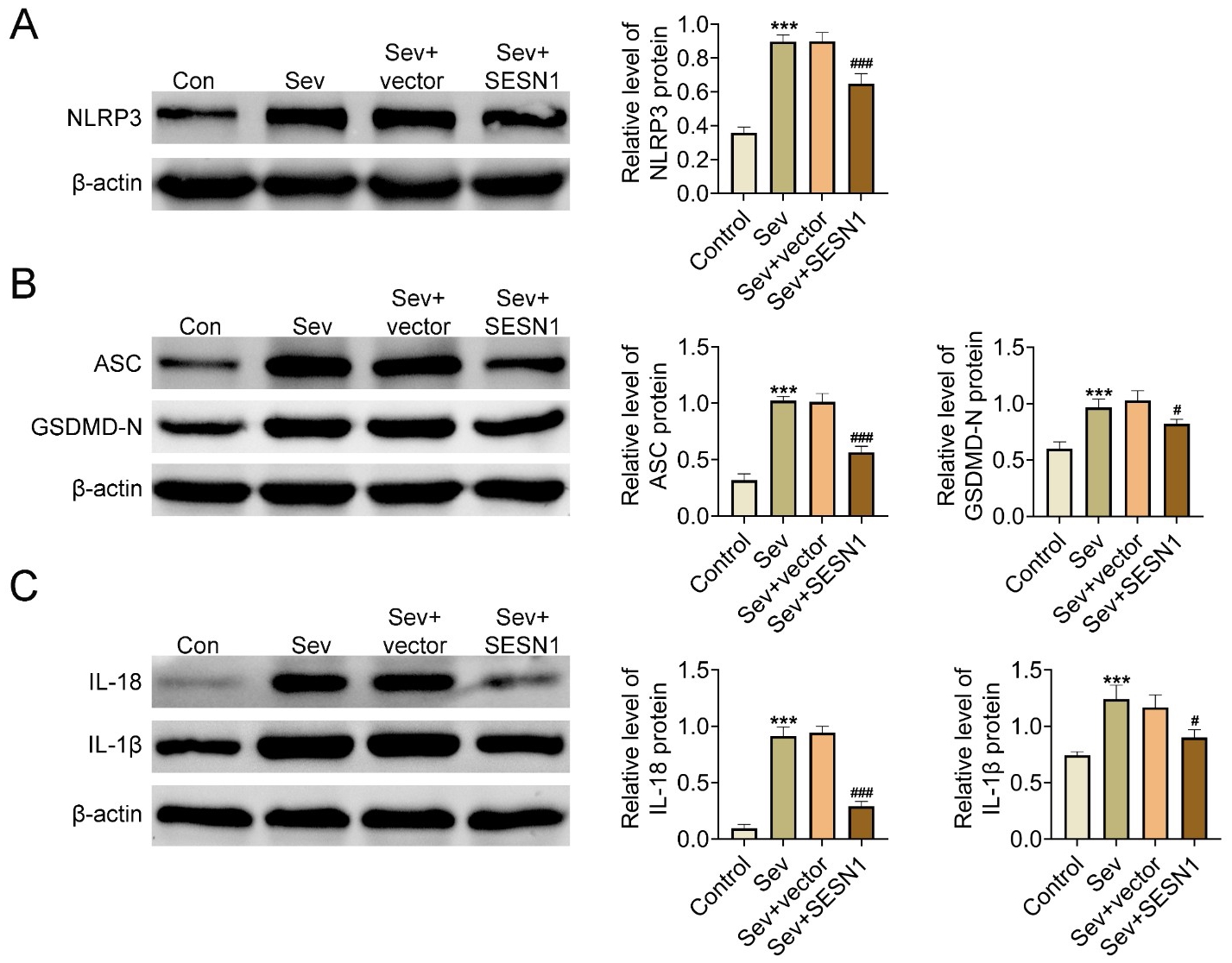 SESN1 inhibits NLRP3 inflammasome activation. (A) The
expression of NLPRP3 in response to SESN1 and SEV in cells upon the indicated
treatment was detected through Immunoblot assays. The quantification was
conducted. (B) The expression of ASC and GSDMD-N in response to SESN1 and SEV in
cells upon the indicated treatment was detected through Immunoblot assays. The
quantification was conducted. (C) The expression of IL-1β and IL-18 in
response to SESN1 and SEV in cells upon the indicated treatment was detected
through Immunoblot assays. The quantification was conducted. ***, p <
0.01 SEV vs. control; #, p < 0.05, ###, p <
0.001 SEV + SESN1 vs. SEV + vector. SESN1: Sestrin 1; NLRP: NOD-like
receptor thermal protein domain associated protein; SEV: sevoflurane; ASC:
Apoptosis-associated speck-like protein containing a CARD; IL: interleukin.