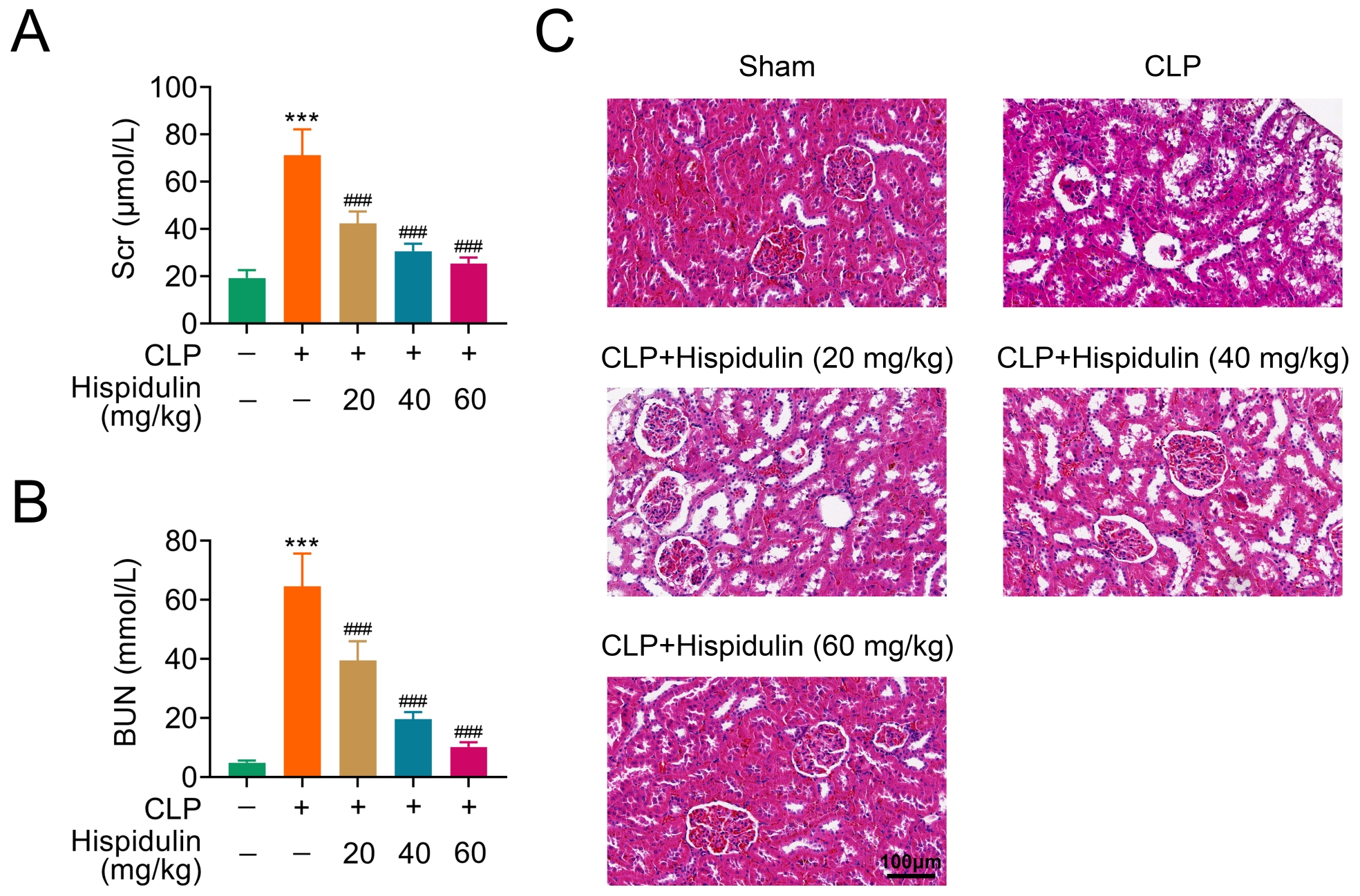 Hispidulin impacts on acute kidney injury induced by CLP in
mice. (A,B) Automatic biochemical analyzer measured the expression levels of Scr
and BUN. (C) Histopathological changes measured after CLP operation and
hispidulin treatment by staining with H&E. ###p < 0.005
vs. CLP. ***p < 0.005 vs. sham. Data were presented
as mean ± SEM. CLP: cecal ligation and puncture; Scr: serum creatinine;
BUN: blood urea nitrogen.