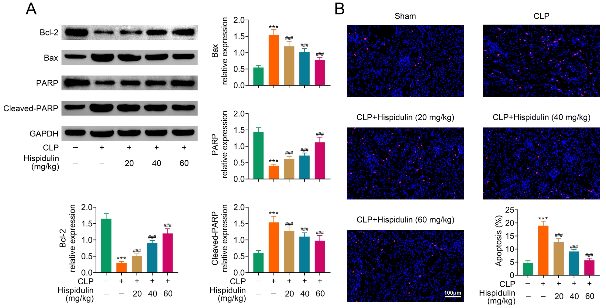 Impact of hispidulin on cellular apoptosis induced by CLP in
kidney tissue. (A) Western blot analysis examined the protein expression of Bax,
Bcl-2, PARP and Cleaved-PARP. (B) TUNEL assay evaluated apoptosis cell rate of
kidney tissue. ###p < 0.005 vs. CLP. ***p <
0.005 vs. sham. Data were presented as mean ± SEM. CLP: cecal
ligation and puncture; Bcl: B-cell lymphoma; PARP: Poly (ADP-ribose) polymerases;
GAPDH: glyceraldehyde-3-phosphate dehydrogenase.