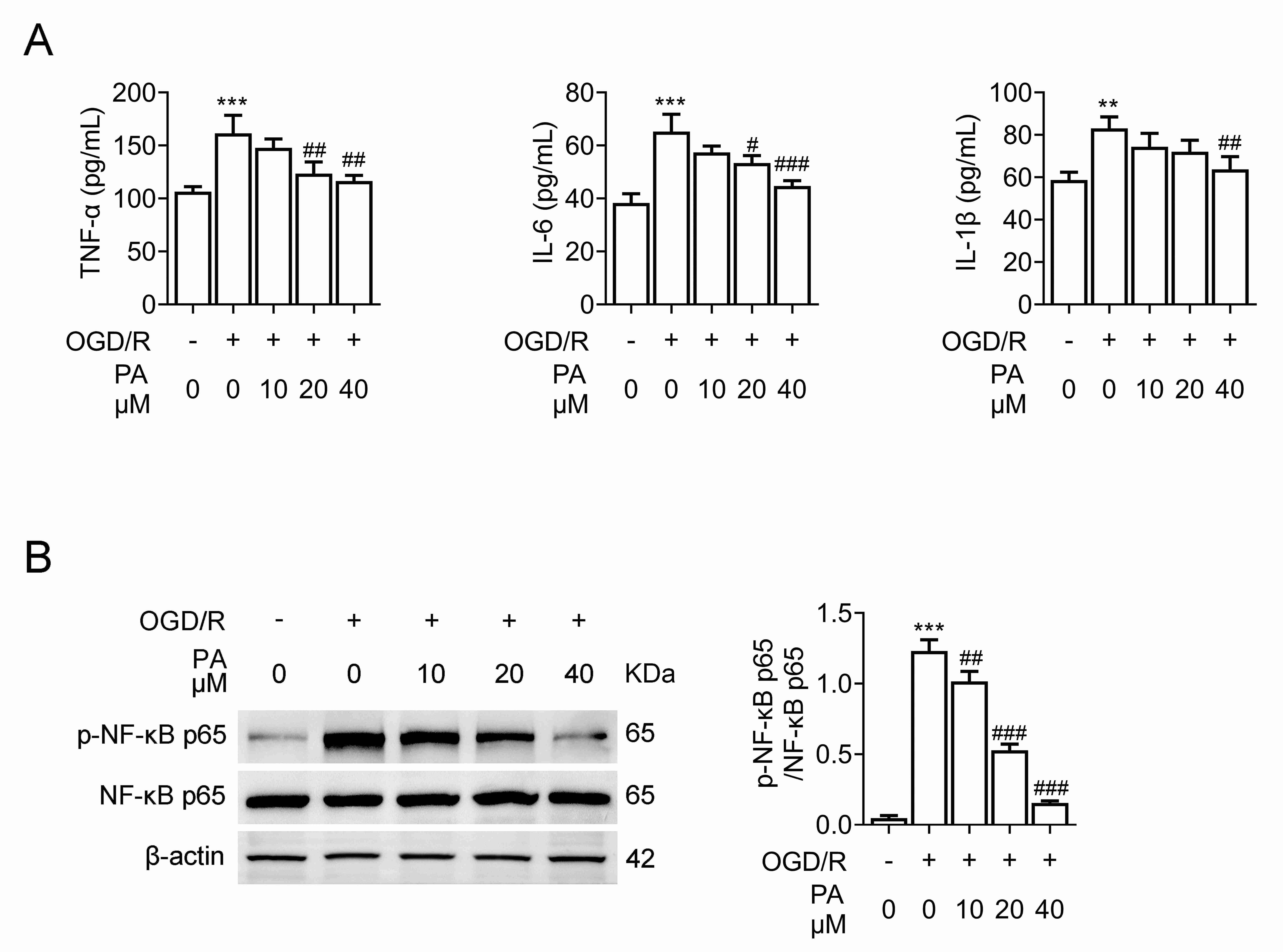 PA suppresses the inflammation of PC12 cells induced by OGD/R. (A) ELISA assays showed the secretion of IL-1β, IL-6 and TNF-α
in PC12 cells with or without OGD/R upon the treatment of PA for 24 h at 10, 20
and 40 µM concentrations. (B) The phosphorylation levels and expression of
NF-κB p65 in PC12 cells were depicted with or without OGD/R through
immunoblot assays upon the PA treatment at concentrations of 10, 20 and 40
µM for 24 h. Error bar indicates SD. #p < 0.05, ##p
< 0.01, ###p < 0.001, OGD/R + PA vs. OGD/R. **p
< 0.01, ***p < 0.001, OGD/R vs. control. OGD/R:
oxygen-glucose deprivation/reoxygenation; PA: Physalin A; TNF-α: tumor
necrosis factor-α; IL: interleukin; NF-κB: nuclear factor
kappa-B.