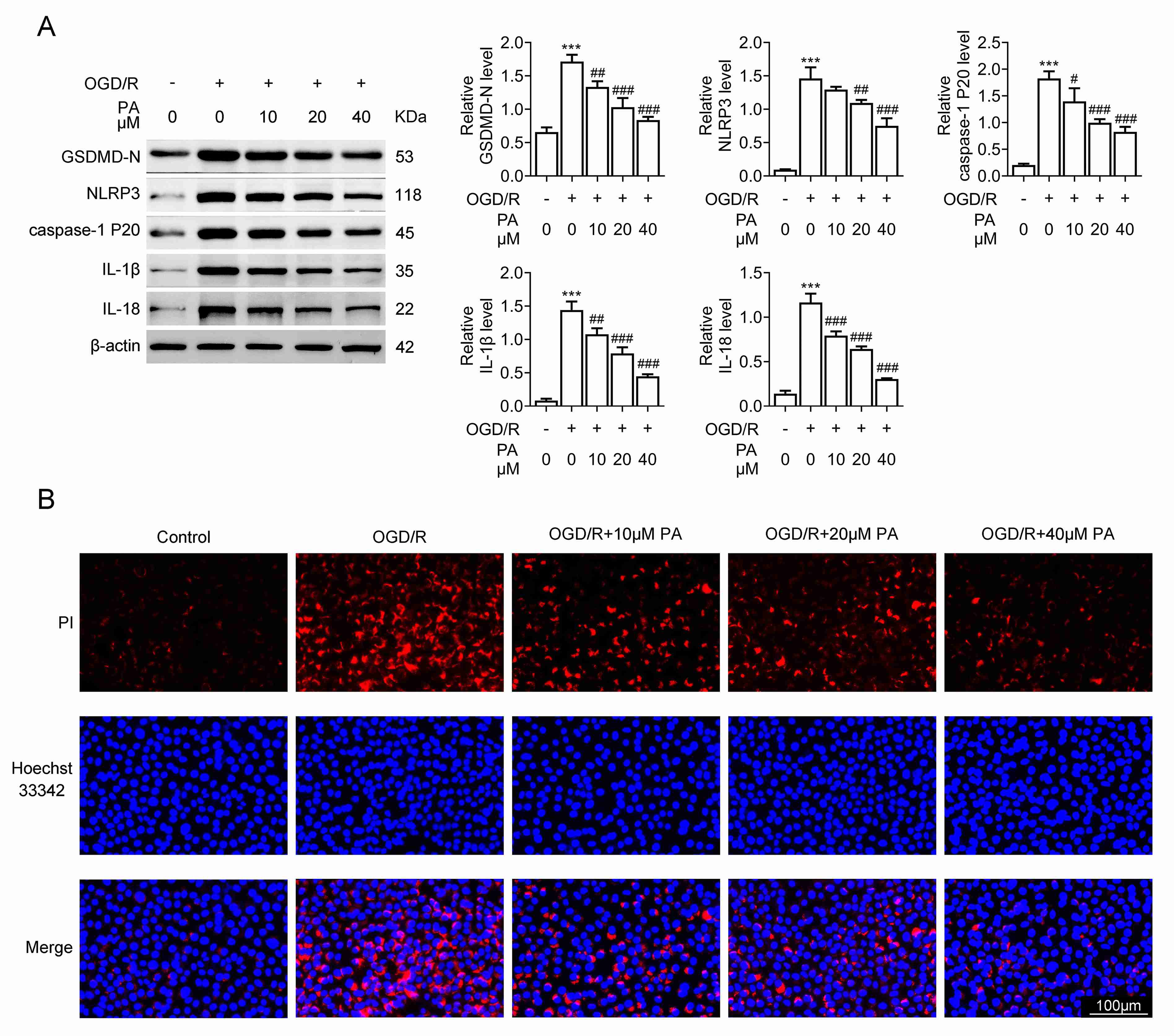 PA inhibited the pyroptosis of OGD/R-induced PC12 cells. (A)
Immunoblot assays showed proteins expression in PC12 cells with or without OGD/R
upon PA treatment for 24 h at 10, 20 and 40 µM concentrations. (B)
Immunostaining assays showed the expression of Propyl iodide (PI) and hoechst in
PC12 cells with or without OGD/R upon PA treatment at concentrations of 10, 20
and 40 µM for 24 h. Error bar indicates SD. #p < 0.05,
##p < 0.01, ###p < 0.001, OGD/R + PA vs.
OGD/R. ***p < 0.001, OGD/R vs. control.
