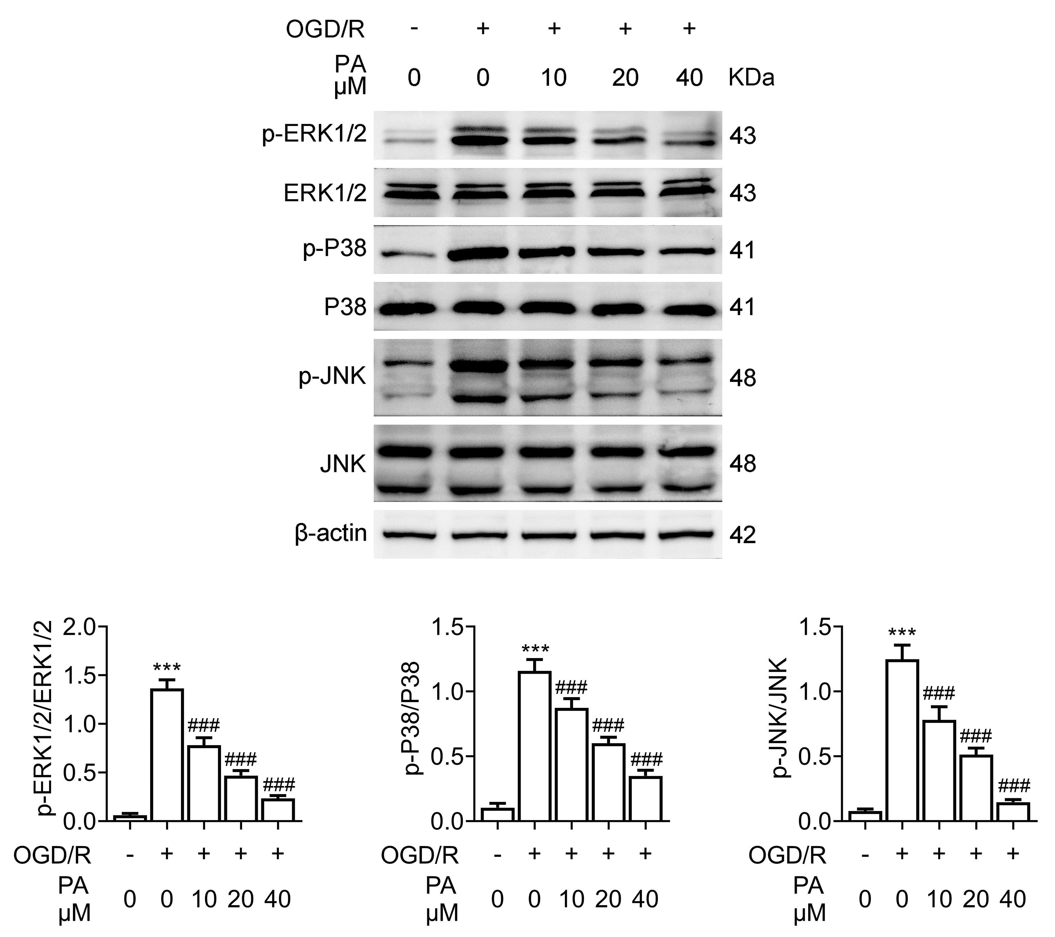PA inhibited MAPK pathway activation in OGD/R-induced PC12
cells. Immunoblot assays depicted the phosphorylation levels and expression of
ERK1/2, p38 and JNK in PC12 cells upon PA treatment with or without OGD/R at
concentrations of 10, 20 and 40 µM for 24 h. Error bar indicates SD.
###p < 0.001, OGD/R + PA vs. OGD/R. ***p <
0.001, OGD/R vs. control. ERK: extracellular regulated protein kinases.