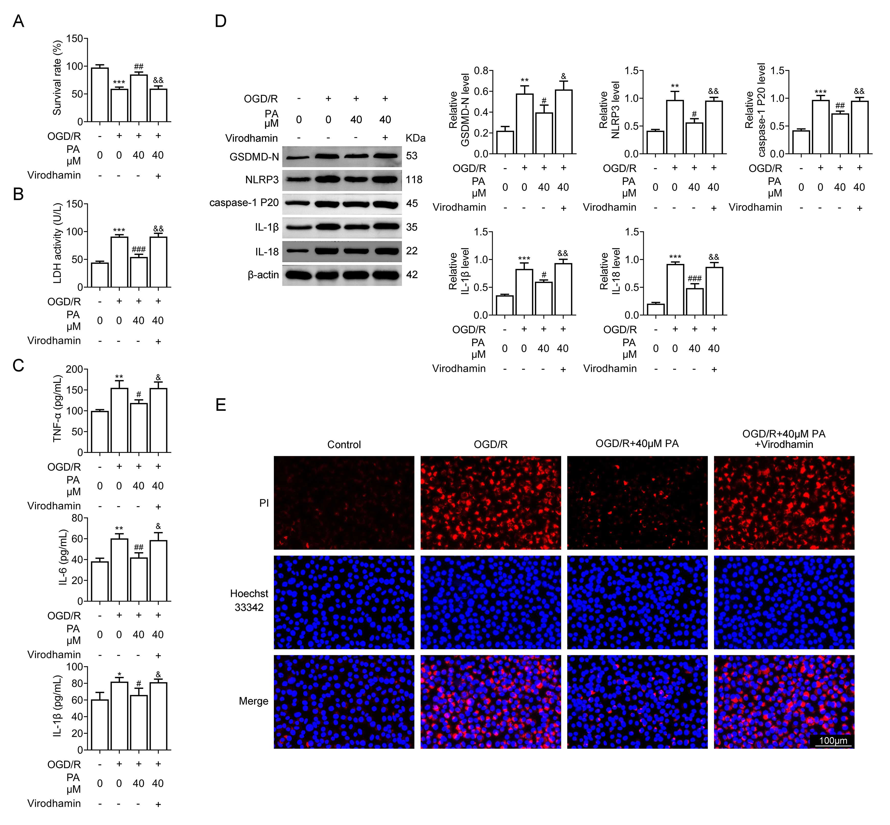 MAPK pathway activation reversing PA neuroprotective impact in
PC12 cells induced by OGD/R. (A) MTT assays showed the PC12 cells viability on
indicated treatment. (B) LDH releasing assays showed LDH levels and cell damage
degree of PC12 cells. (C) ELISA assays revealed secretions of IL-1β, IL-6
and TNF-α in PC12 cells. (D) Immunoblot assays showed the expression of
indicated proteins in PC12 cells. (E) Immunostaining assays depicted the
expression of Propyl iodide (PI) and hoechst in PC12 cells. &p <
0.05, &&p < 0.01, OGD/R + PA + Virodhamin vs. OGD/R + PA.
#p < 0.05, ##p < 0.01, ###p < 0.001, OGD/R
+ PA vs. OGD/R. *p < 0.05, **p < 0.01,
***p < 0.001, OGD/R vs. control. LDH: lactate dehydrogenase.