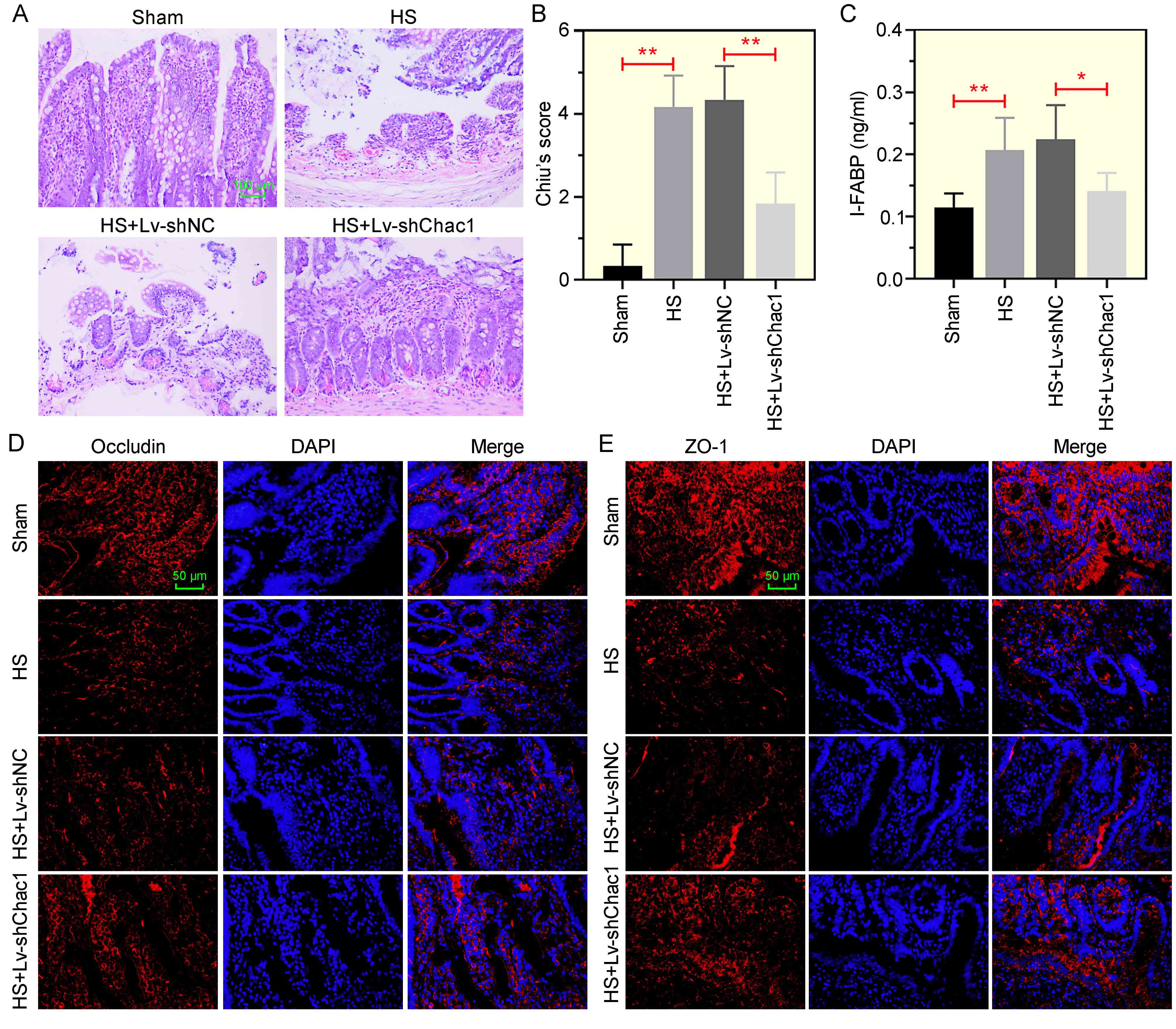 Chac1 knockdown alleviates the HS-induced injury of ileum
tissues. (A) Representative H&E-stained images of ileum tissue from rats with
different treatments assessing the impact of Chac1 on ileum damage. Scale bar:
100 µm. (B) Chiu’s score for ileum tissue based on H&E staining. (C)
Plasma I-FABP level measured by ELISA. (D,E) Immunofluorescence staining showing
the expression of occludin and ZO-1 in ileum tissue. Scale bar: 50 µm.
*p < 0.05, **p < 0.01. HS: hemorrhagic shock; Lv:
lentivirus; shNC: negative control short hairpin RNA; I-FABP: intestinal fatty
acid binding protein; ZO-1: zonula occludens-1; DAPI:
4′,6-diamidino-2-phenylindole.